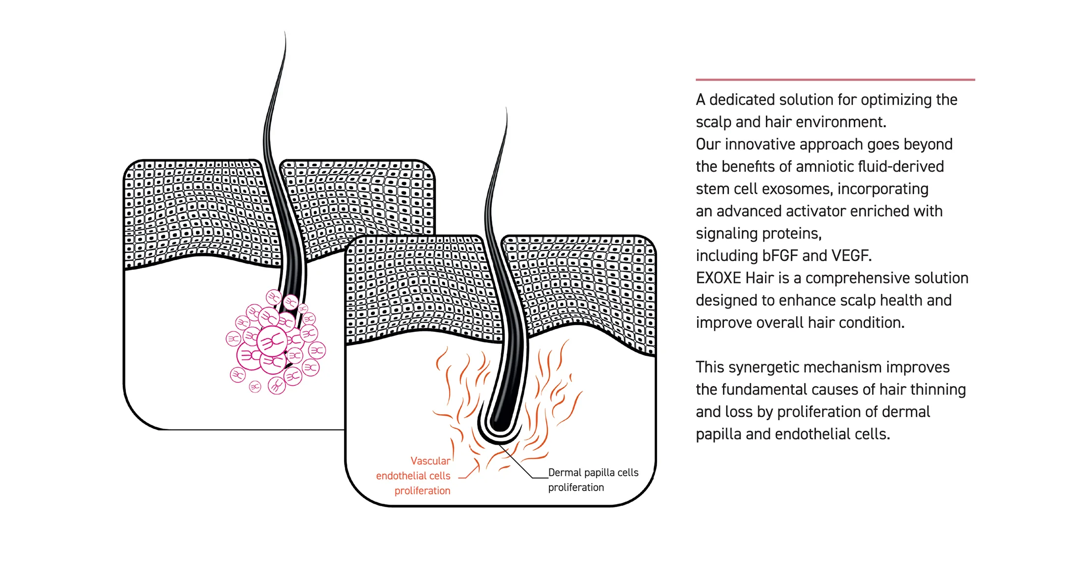 2024 Exoxe Hair 02 7Daffc52 - Botoderm