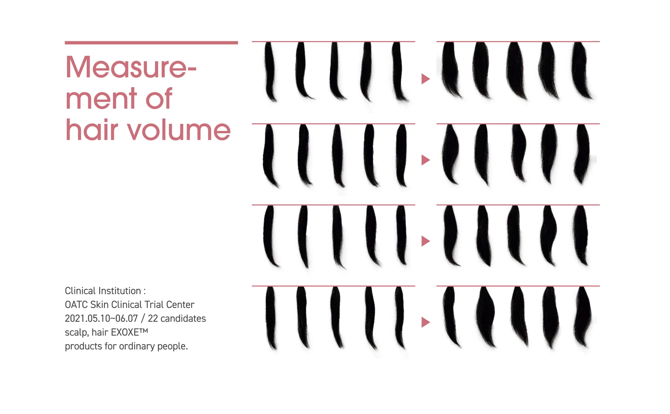 2024 Exoxe Hair 03 5B0A09Cb - Botoderm