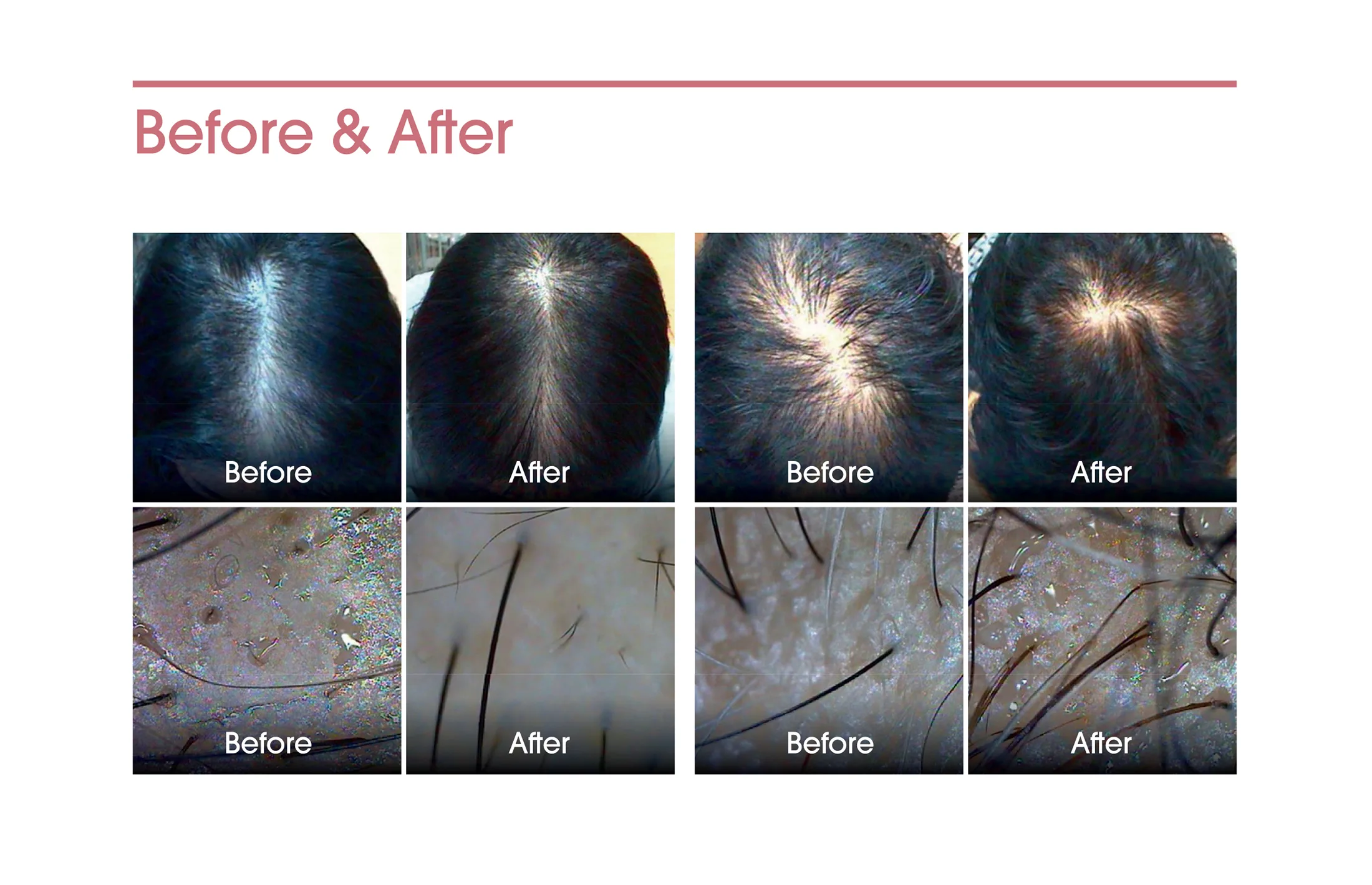 2024 Exoxe Hair 04 740E0F1F - Botoderm