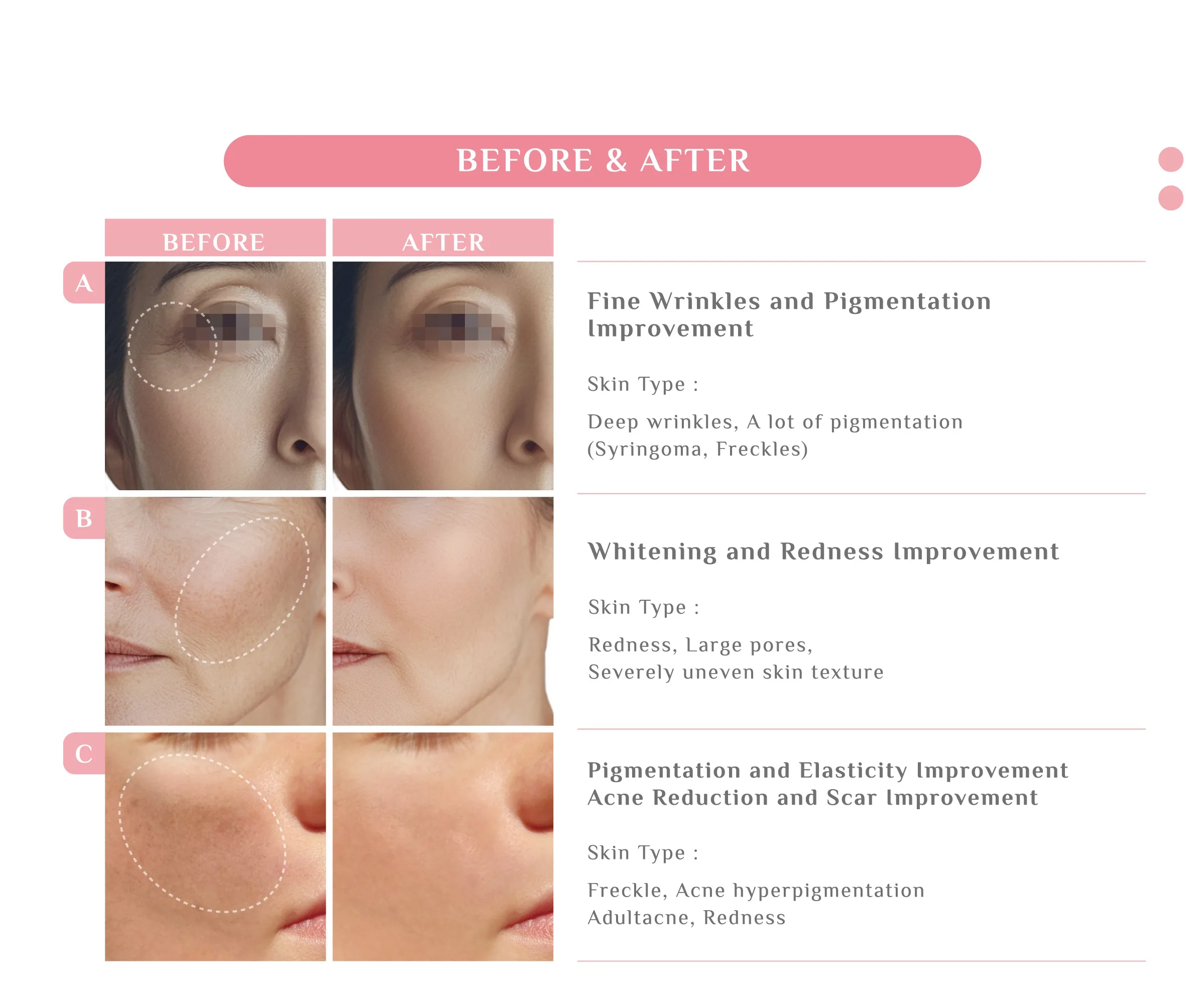 3. Pinklla Brochure 1 05 277C8D3F - Botoderm