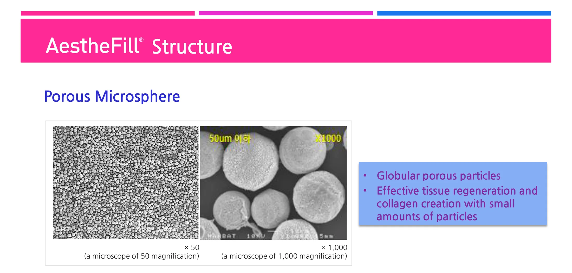Aesthefill Plla 1 07 5C9B3Eef - Botoderm