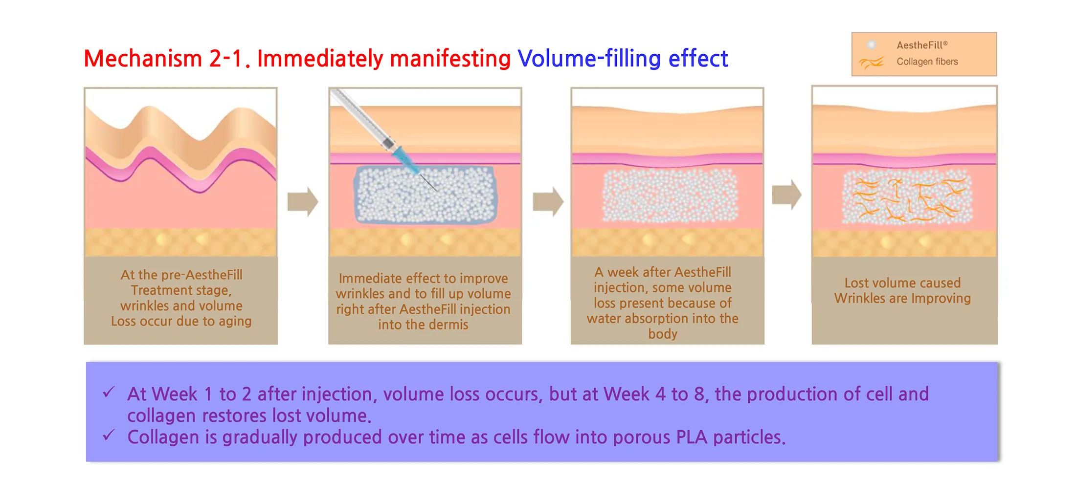 Aesthefill Plla 1 12 Ee738F26 - Botoderm
