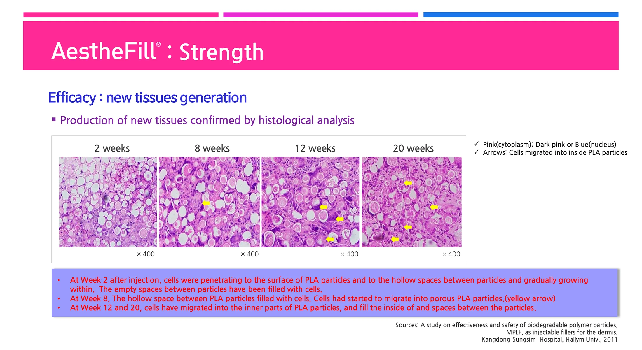 Aesthefill Plla 1 14 B987E4F4 - Botoderm