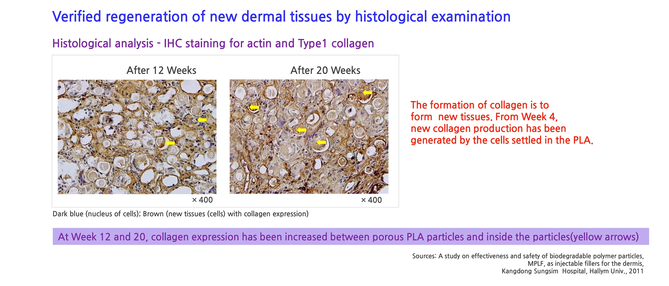 Aesthefill Plla 1 15 Bb2Cebda - Botoderm