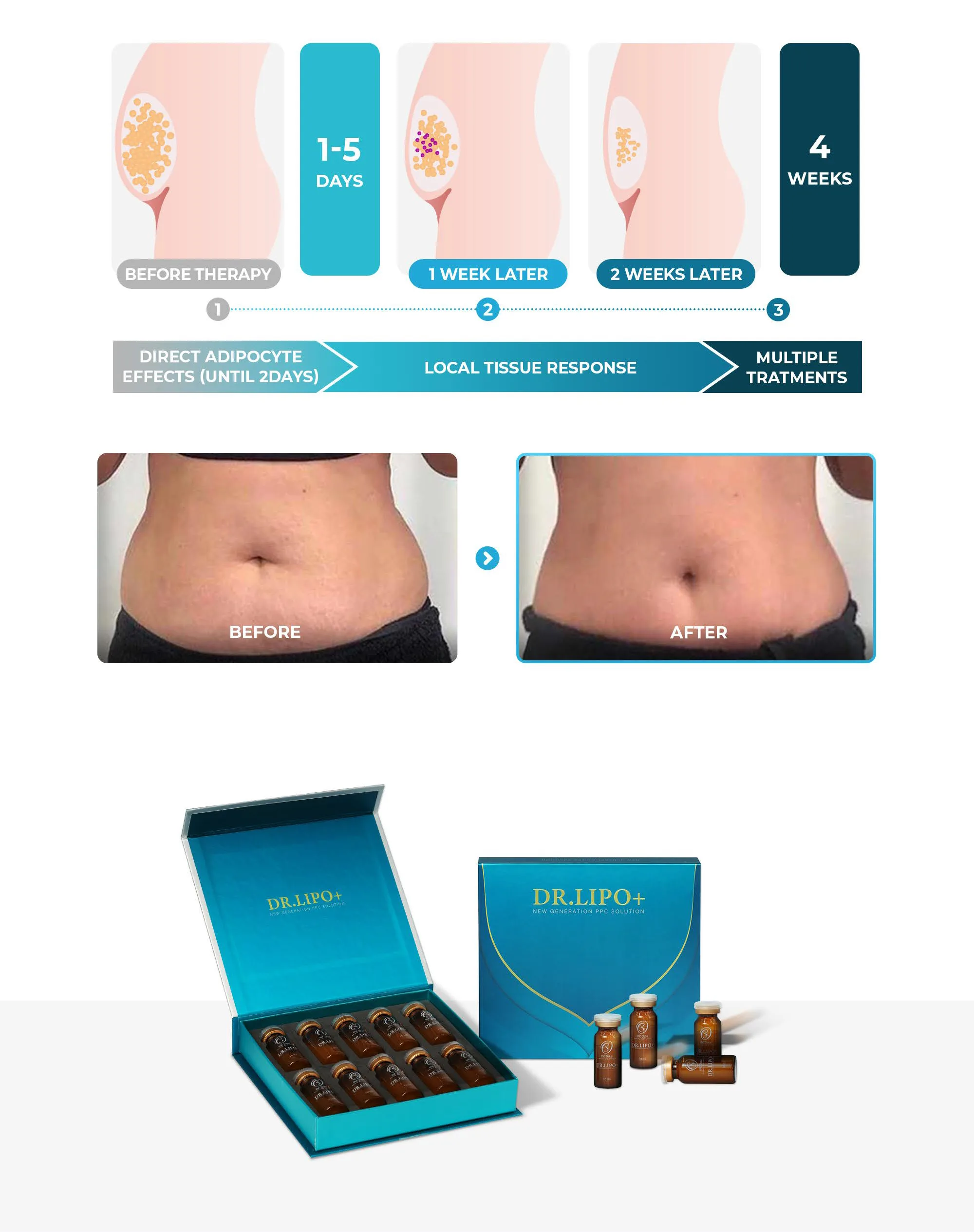 Bnc Drlipo En 05 77491B1B - Botoderm