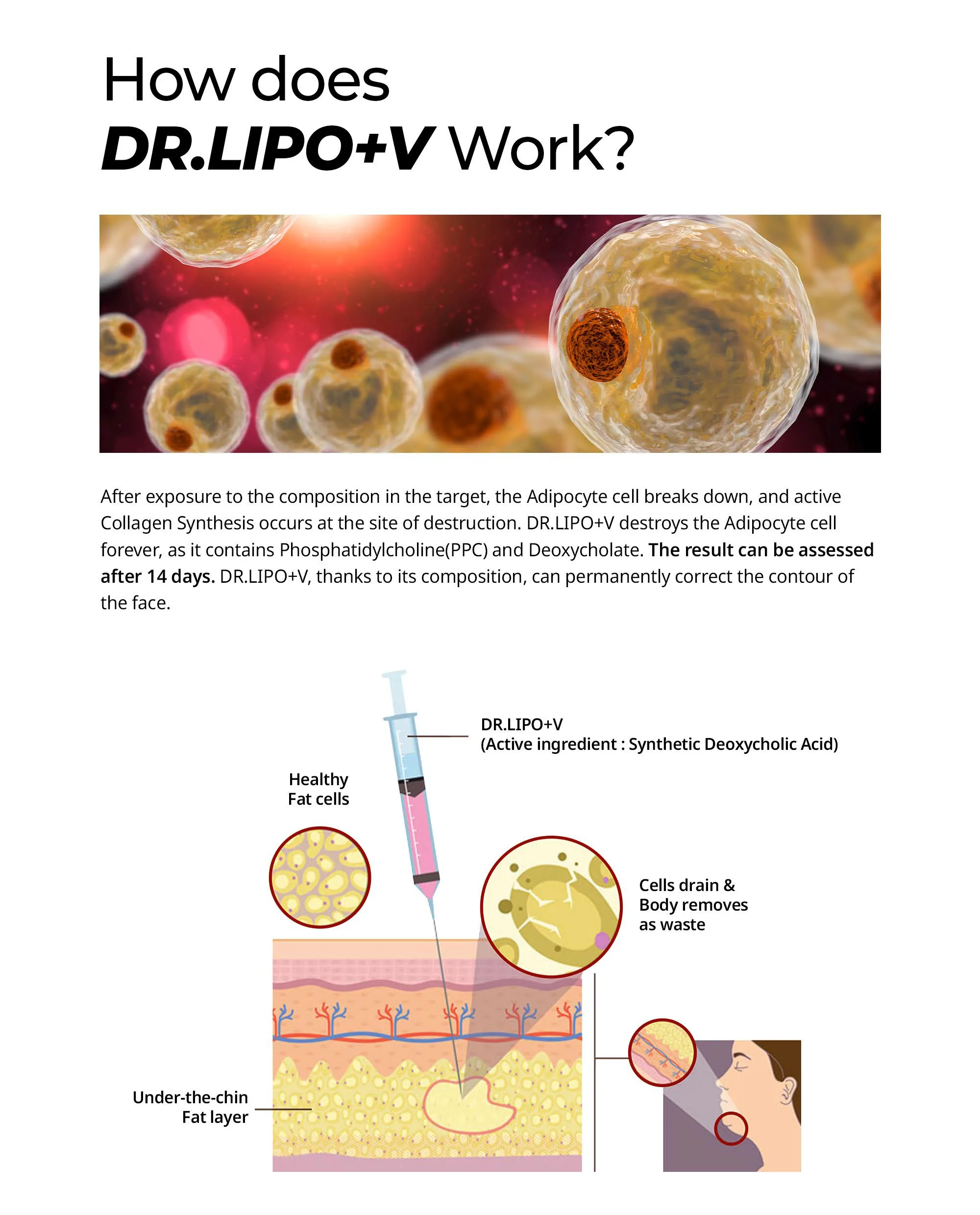Bnc Drlipo V En 03 4D0Bdf2B - Botoderm