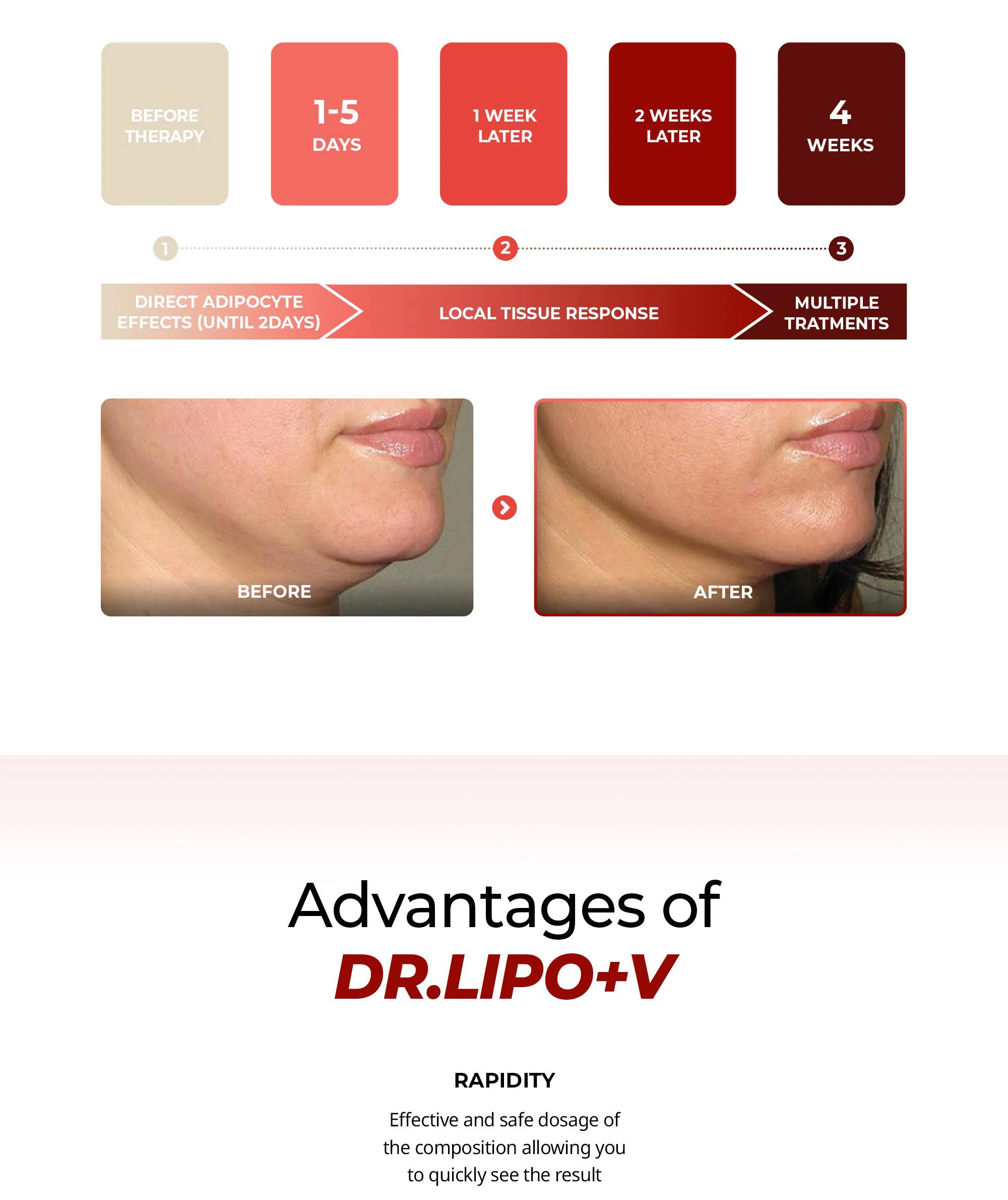 Bnc Drlipo V En 04 C705F37D - Botoderm