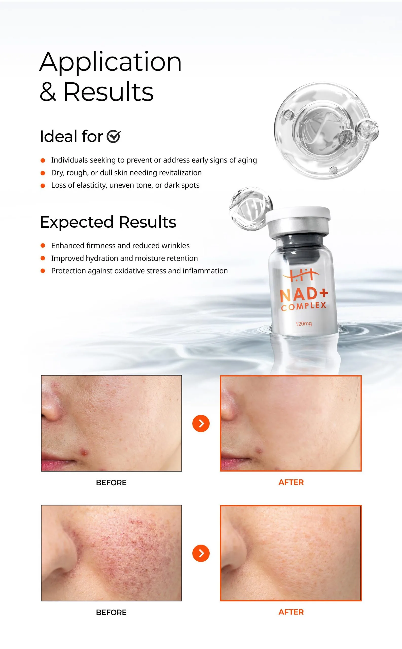 Bnc Hanheal Nad En 07 Scaled 01Bacf62 - Botoderm