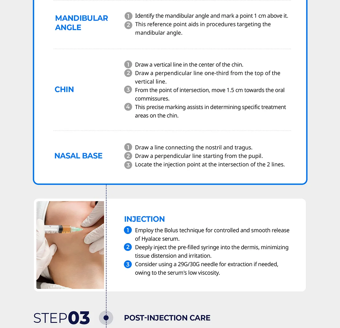Bnc Hyalace En V.2 11 A86E191F - Botoderm