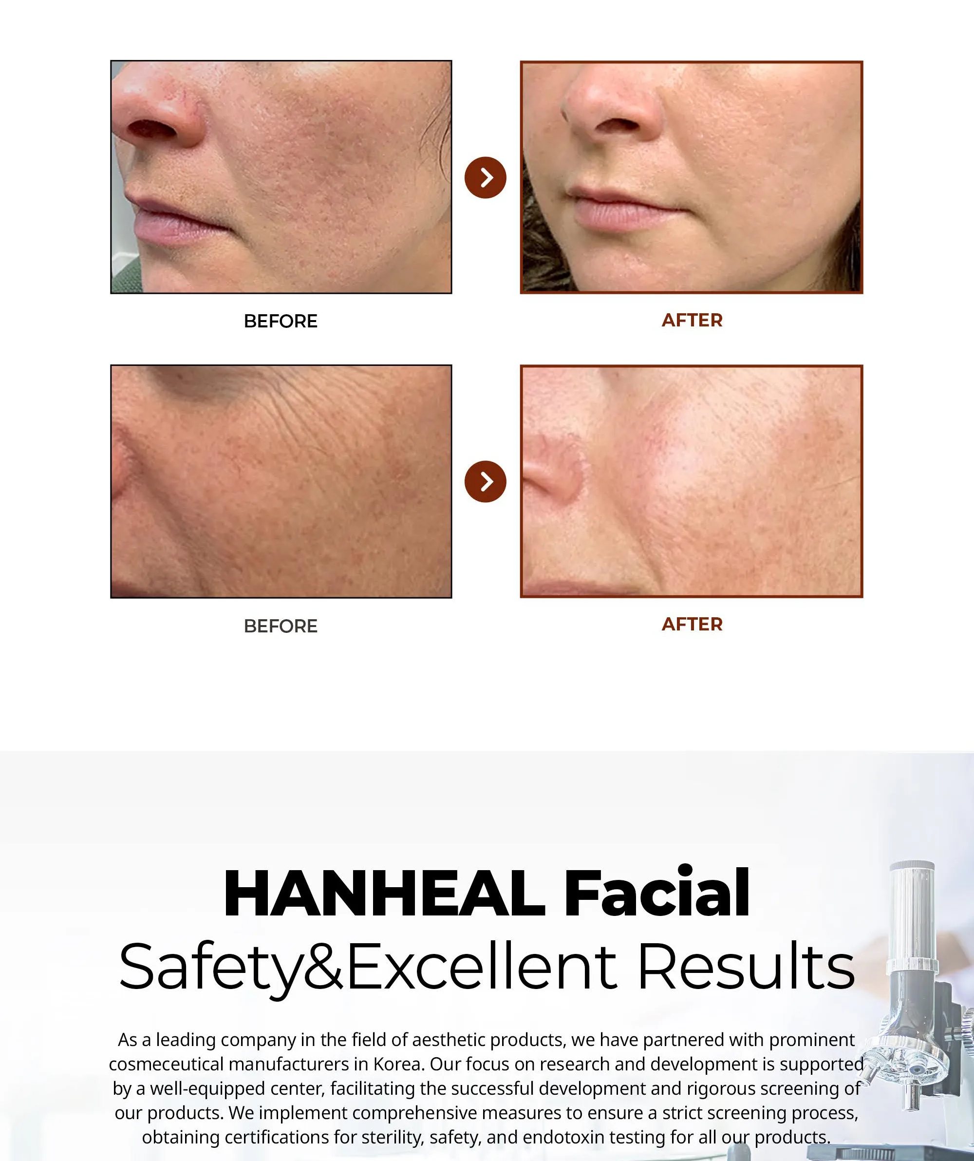 Bnc Hanheal Facial En 08 310Df78F - Botoderm
