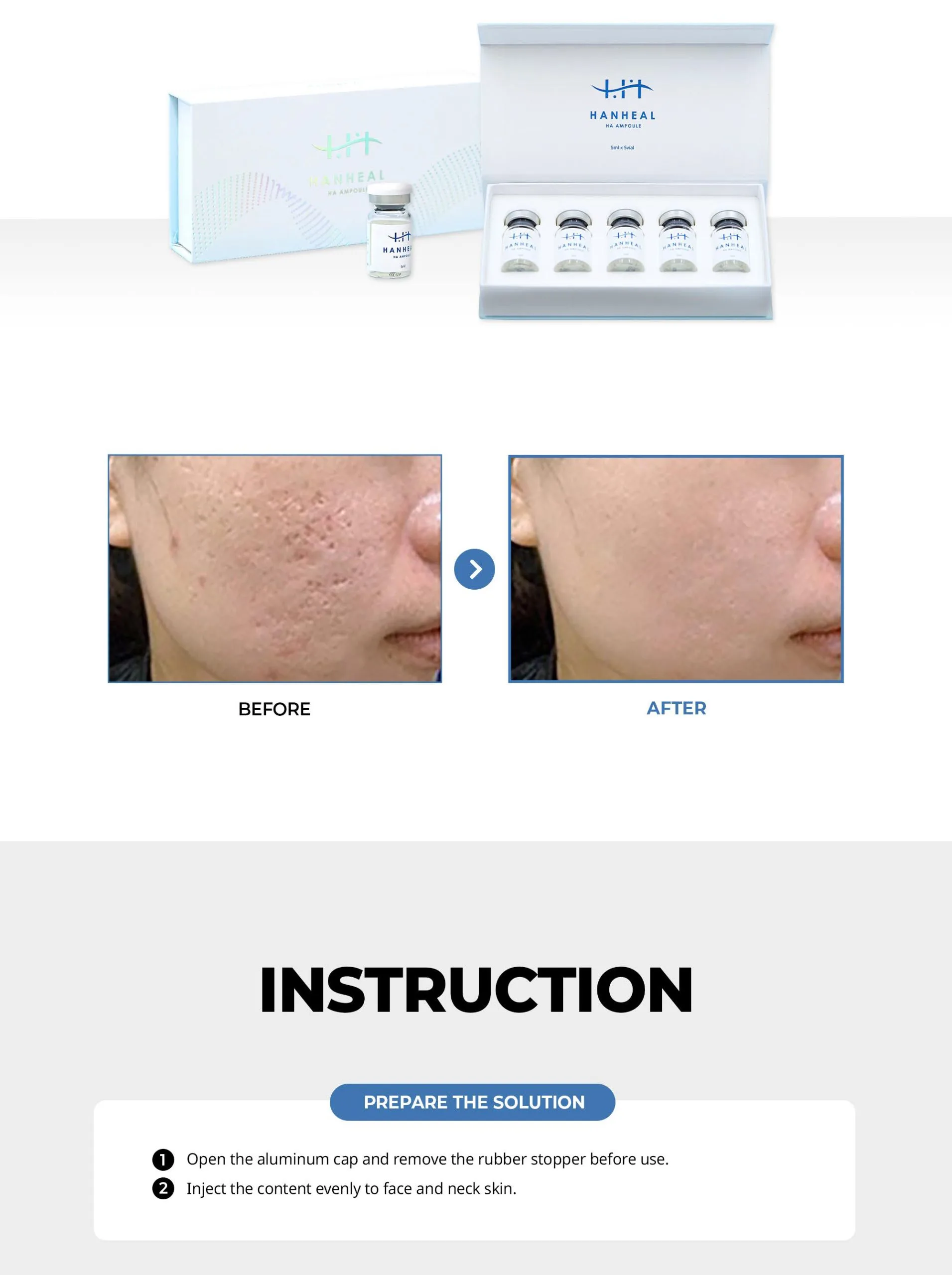 Hanheal Ha Ampoule 9 Bnc Hanheal Ha En 09 Scaled F99A306D - Botoderm