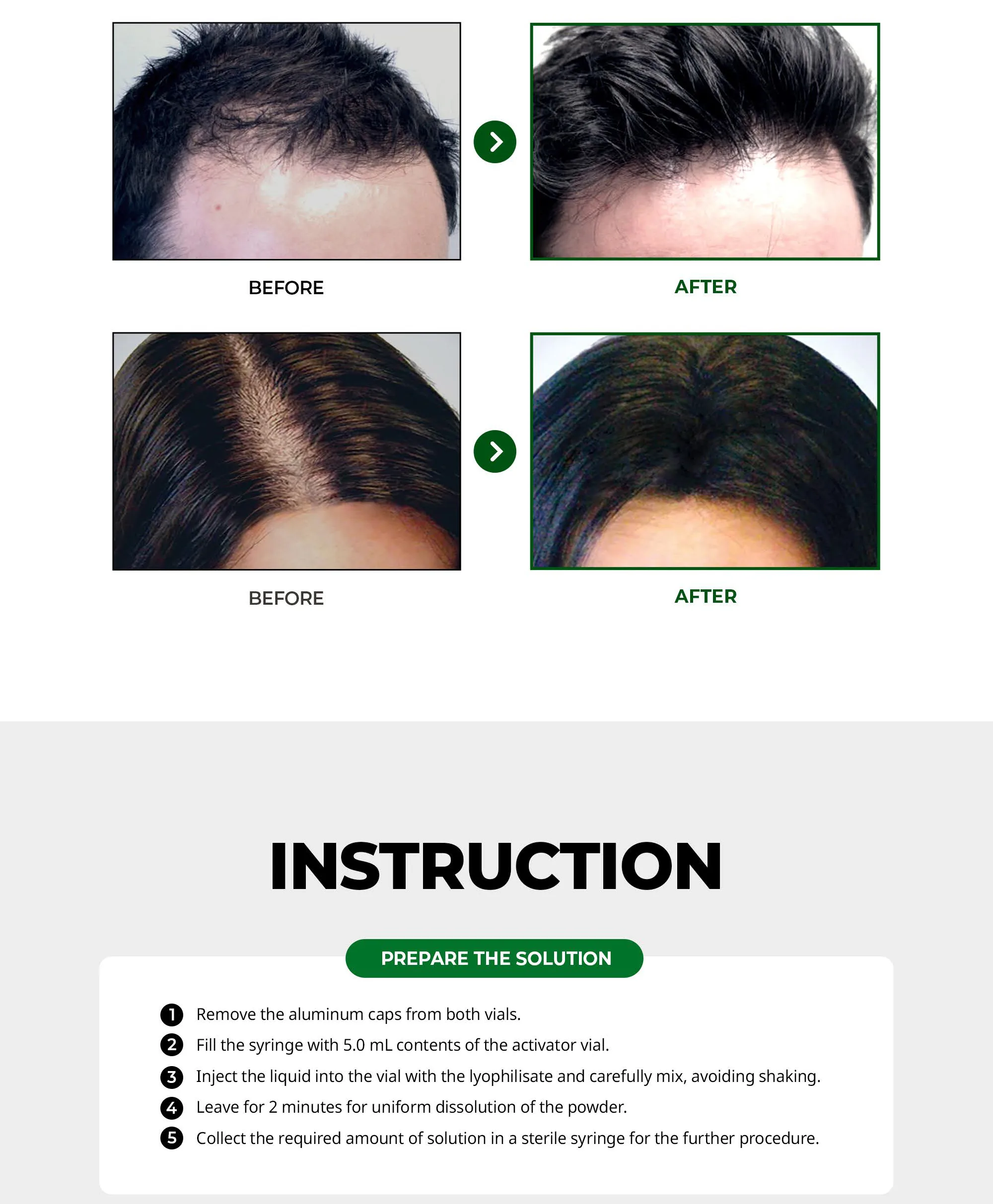 Bnc Hanheal Hair En 10 28E2F13D - Botoderm
