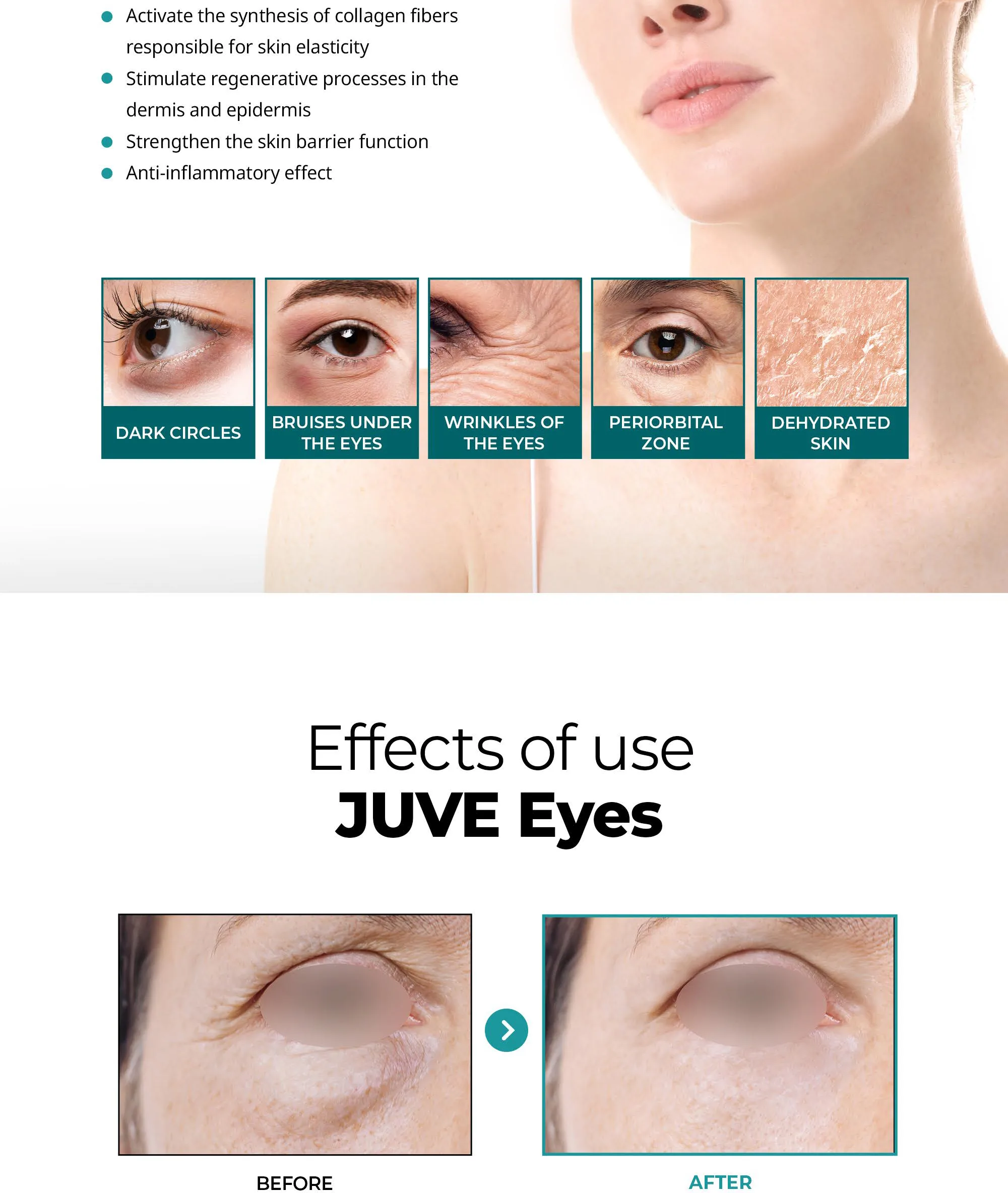 Bnc Juveeyes En 07 0717A58A - Botoderm