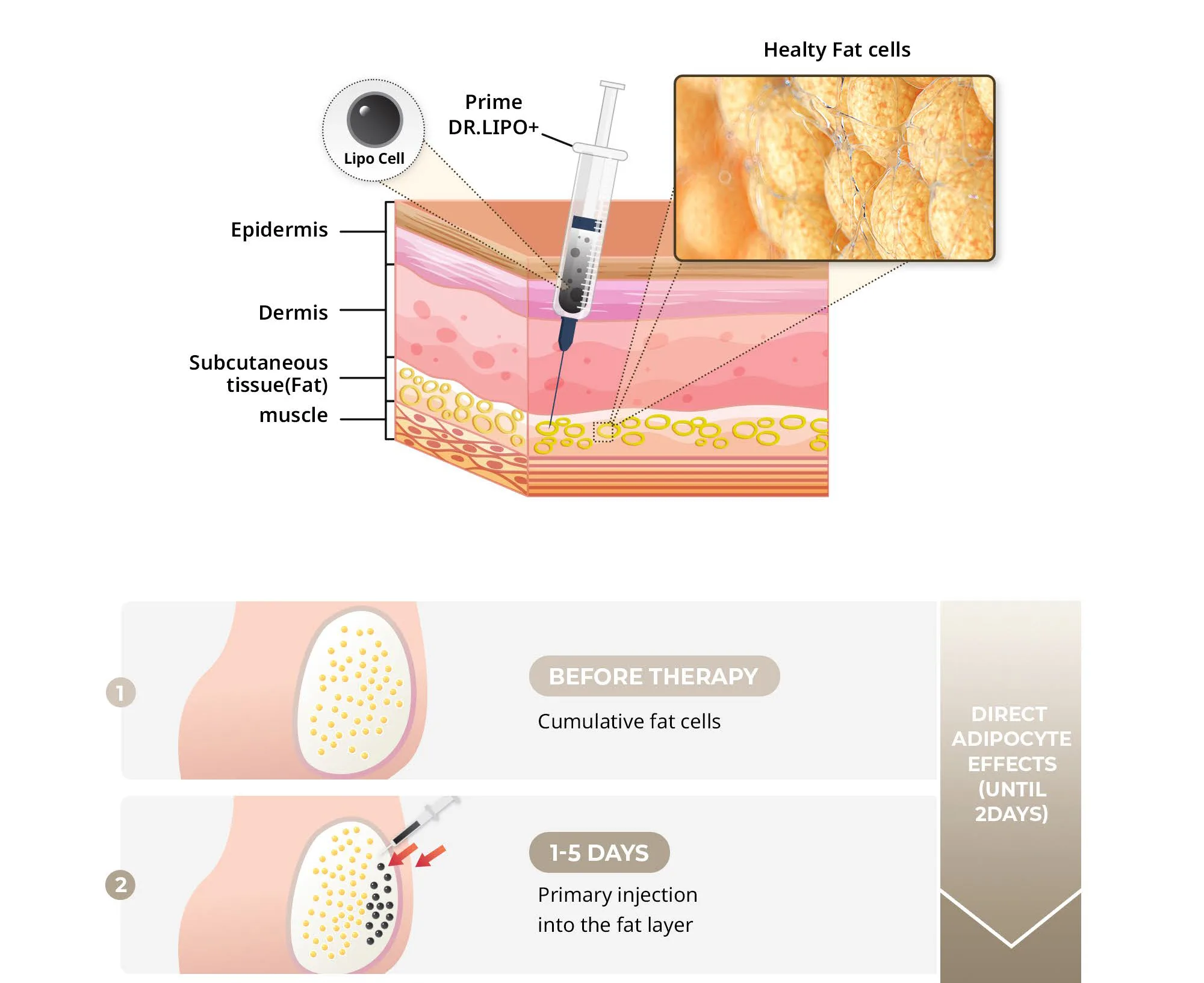 Bnc Primedrlipo En 1 04 Ed2Ed90A - Botoderm