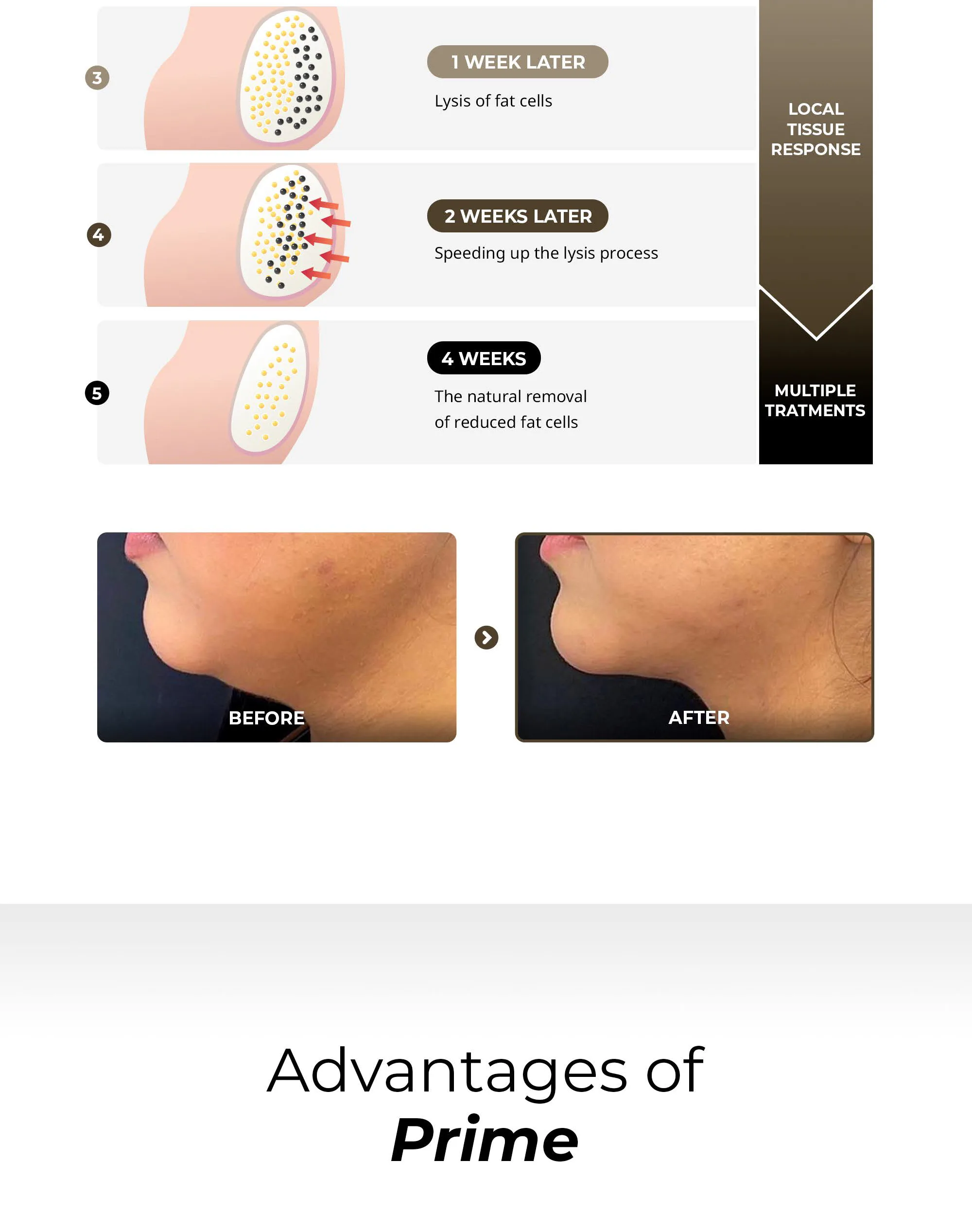 Bnc Primedrlipo En 1 05 16D87C0B - Botoderm