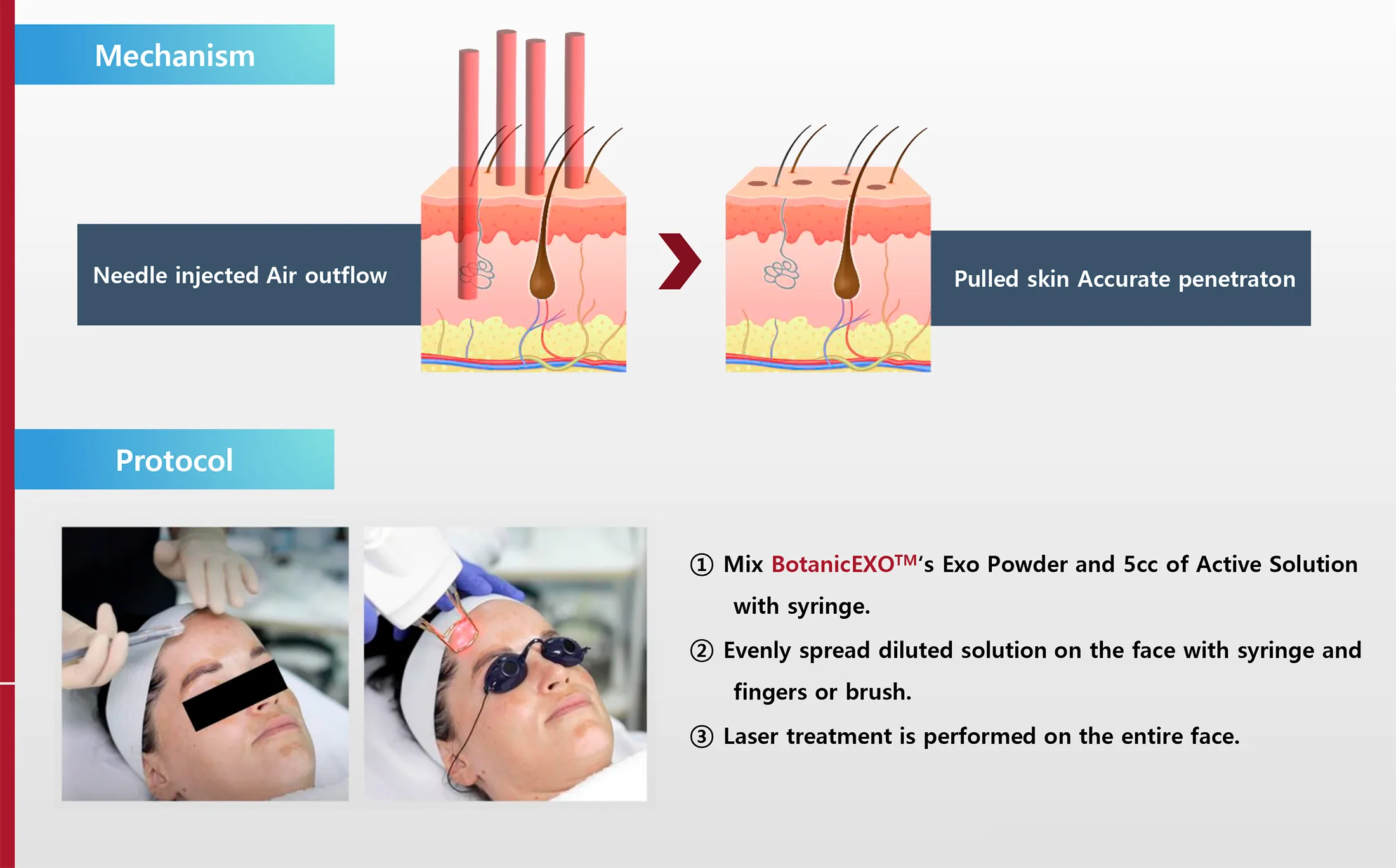 Botanicexo Ifu Ec 98 81 Eb Ac B8 Ec B5 9C Ec A2 85 20230823 1 07 384Edb8C - Botoderm