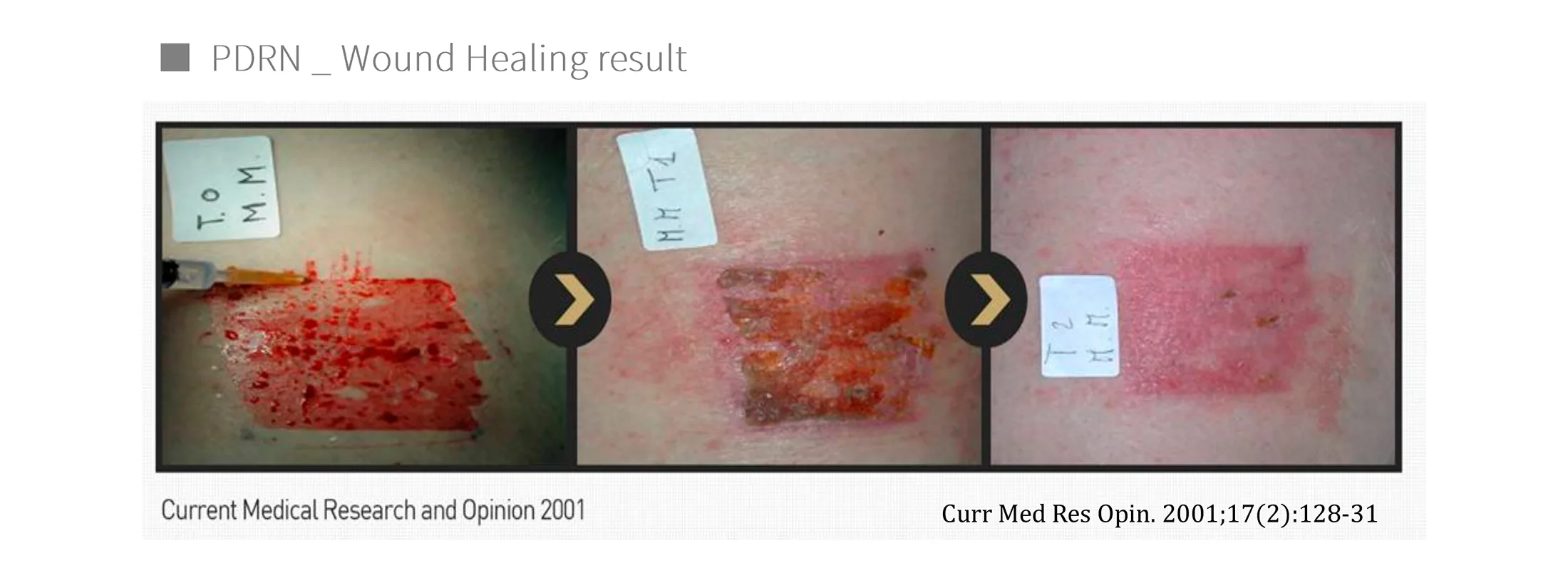 Curenex Rejuvenating 10 84D6Feb0 - Botoderm