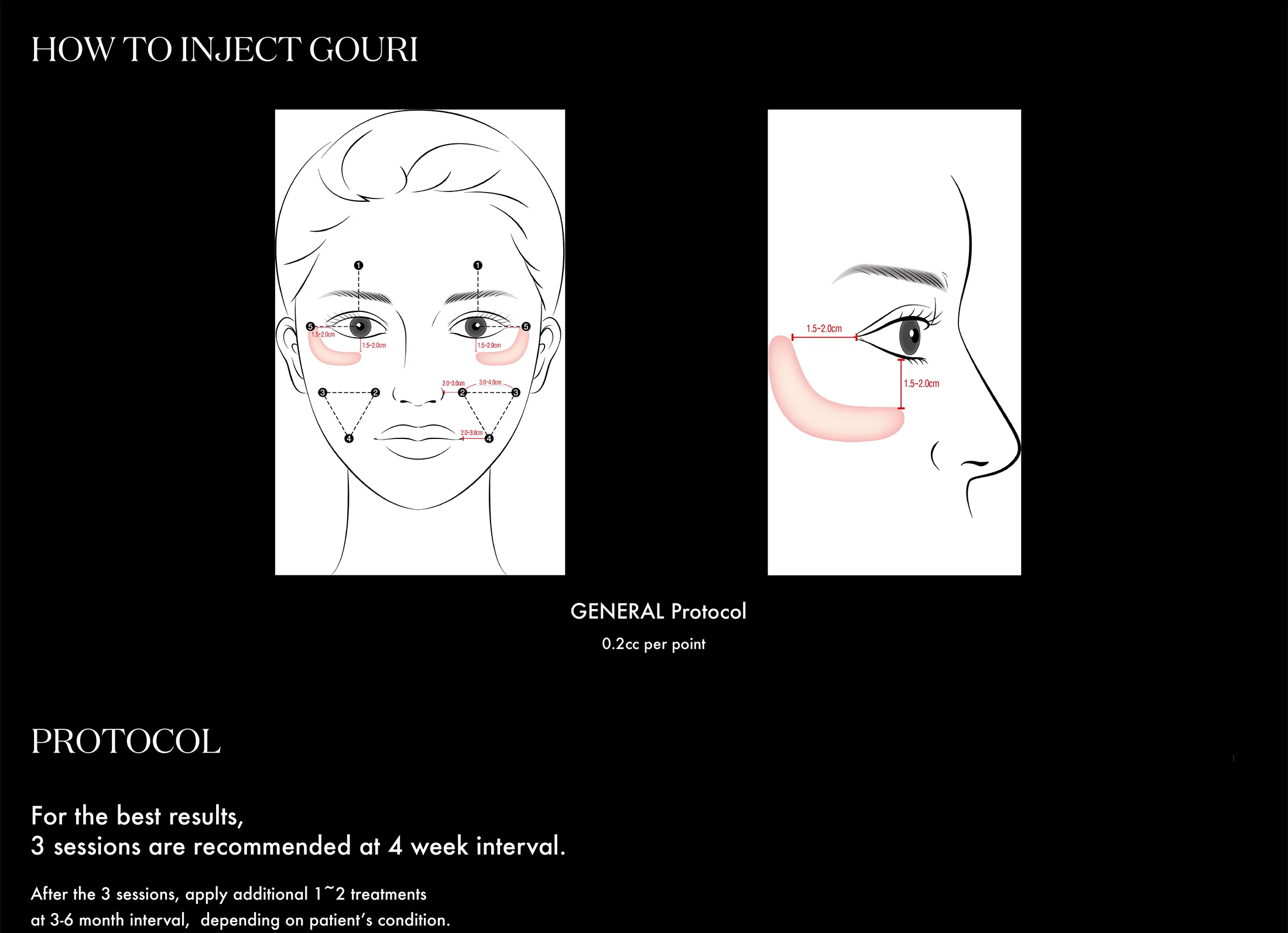 Gouri Ppt 2021 En 18 2 1 04 E7A7E999 - Botoderm