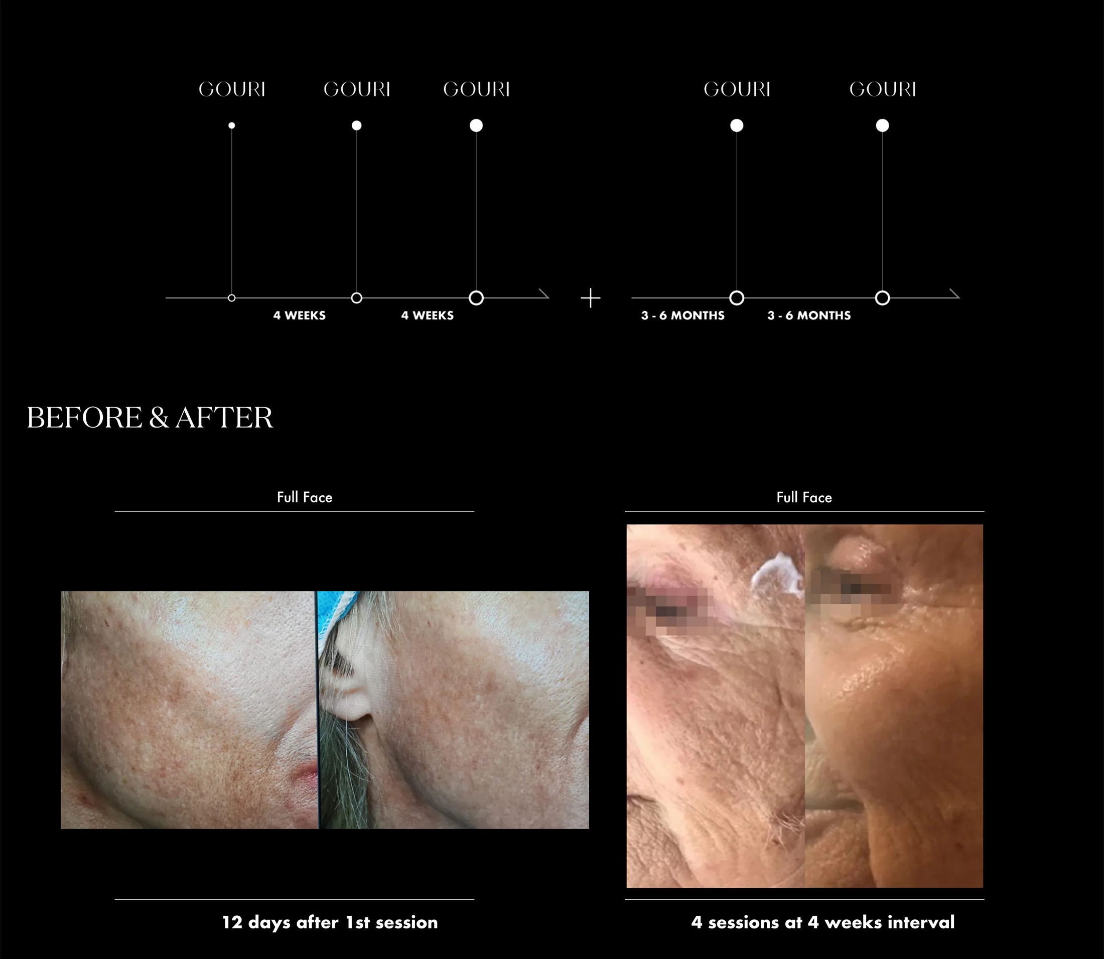 Gouri Ppt 2021 En 18 2 1 05 32193Efa - Botoderm