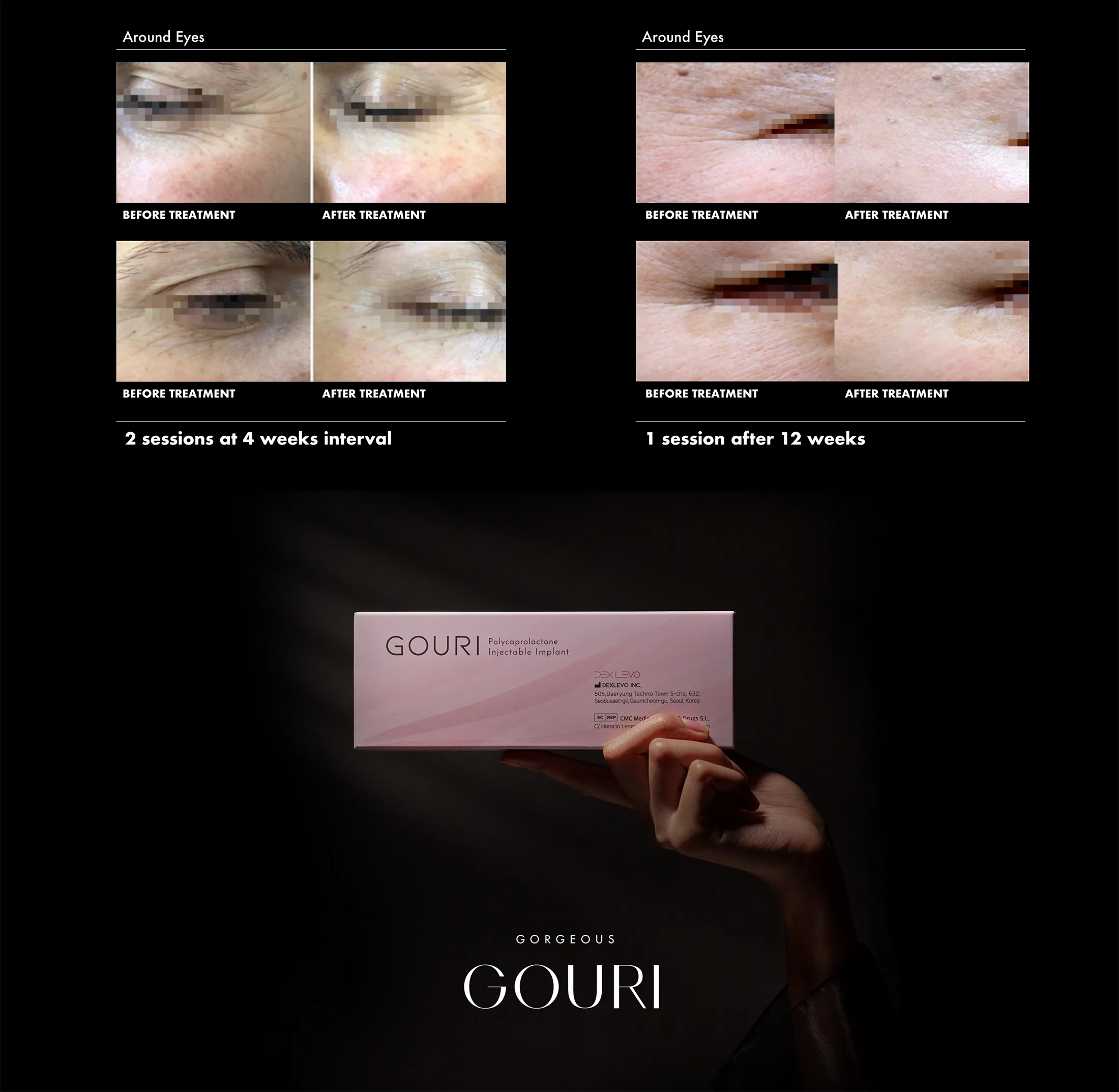 Gouri Ppt 2021 En 18 2 1 06 C699Cbd1 - Botoderm
