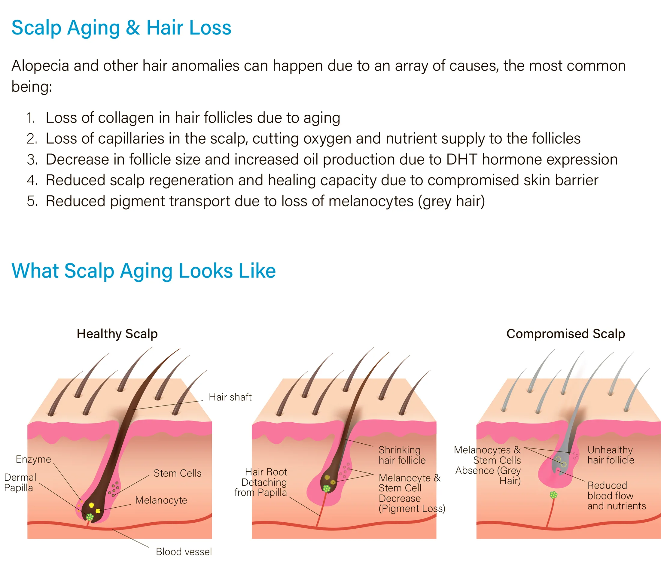 Hairna Hair Fill 1 01 Cc5C8F9E - Botoderm