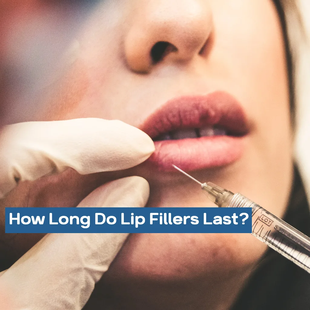 How Long Do Lip Fillers Last? 1 How Long Do Lip Fillers Last? How Long Do Lip Fillers Last Fbc3A246