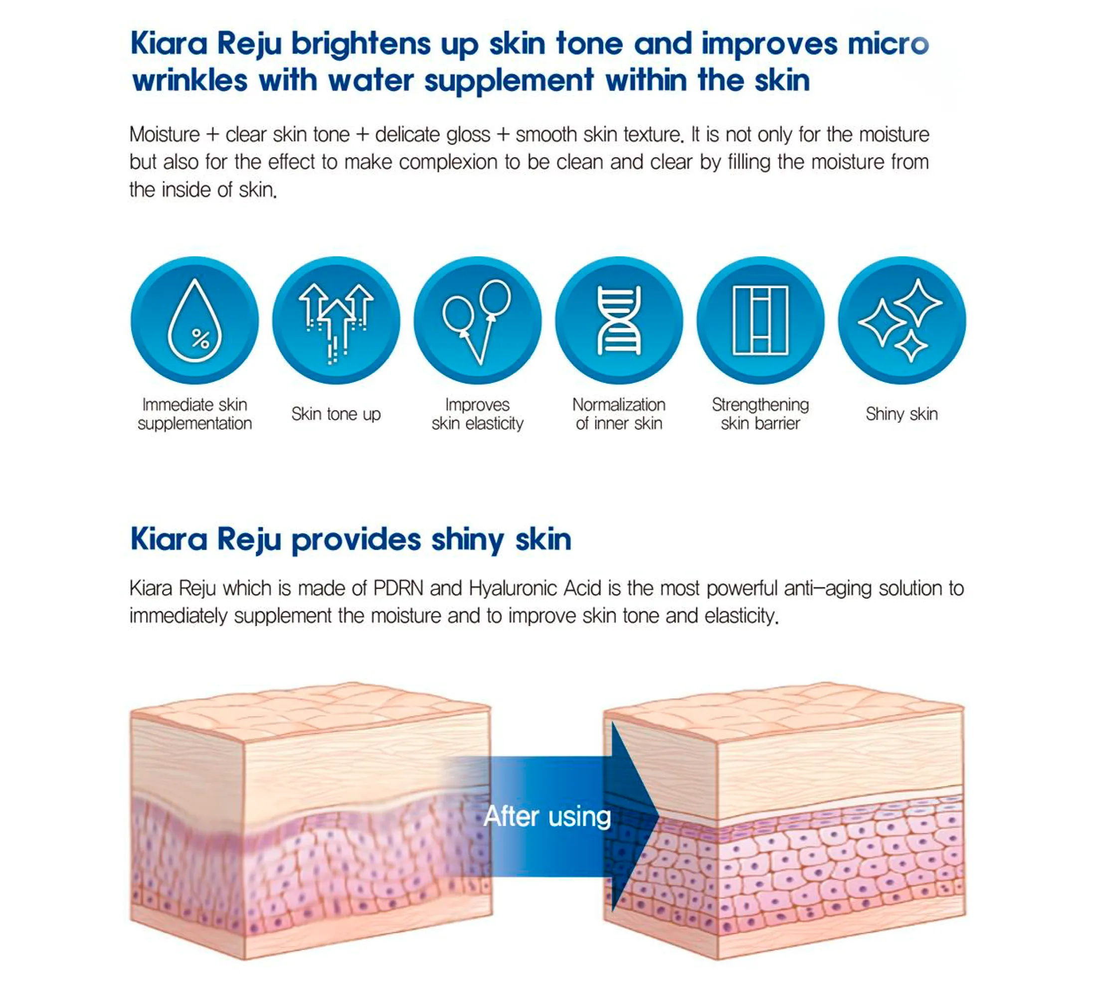 Kiarareju Eng 1 03 8Bb001E4 - Botoderm