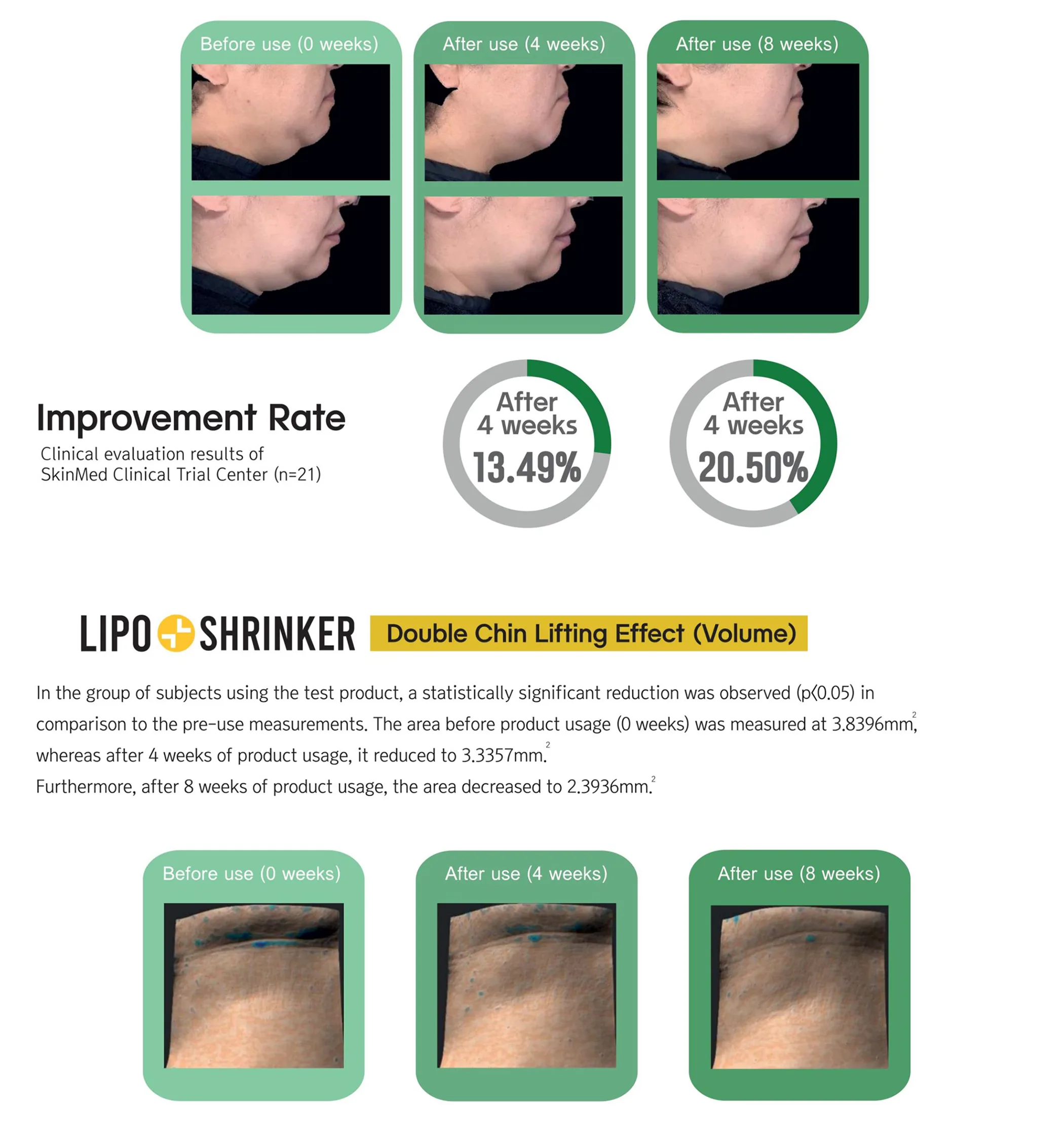 Lipo Shrinker Ppt En 1 04 886F1A3E - Botoderm