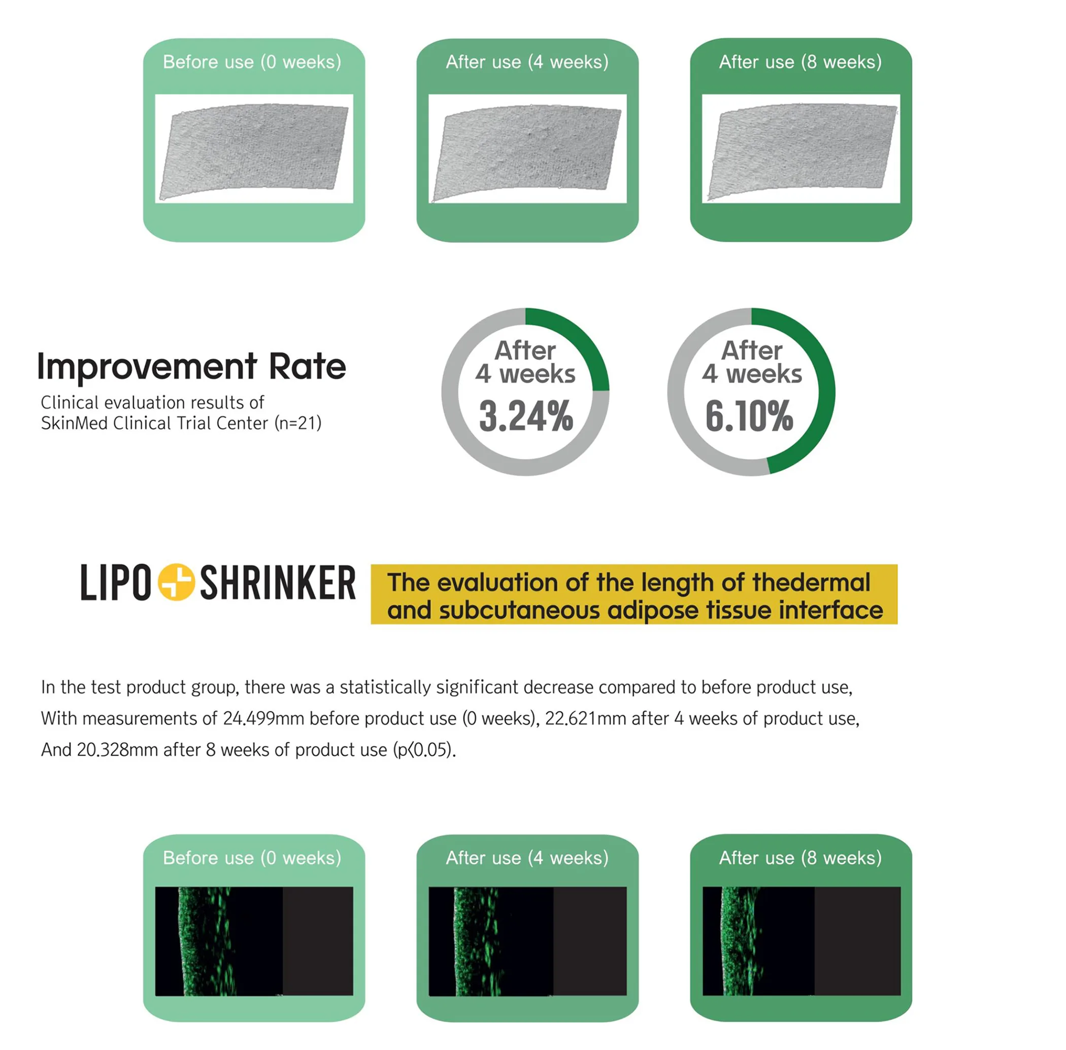 Lipo Shrinker Ppt En 1 06 5Be25008 - Botoderm