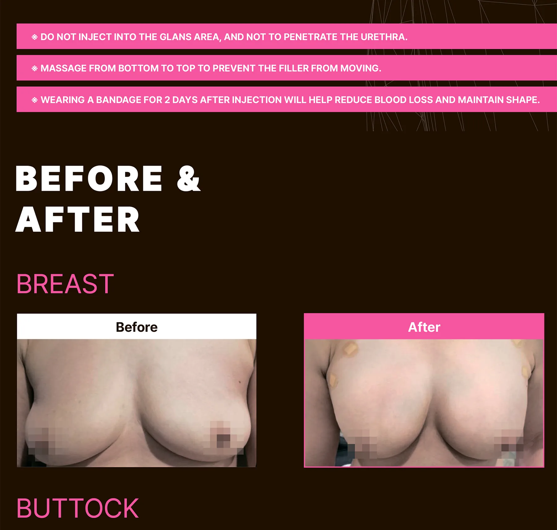 Maxyfill Vial Brochure Renewal 1 2 09 186545F9 - Botoderm