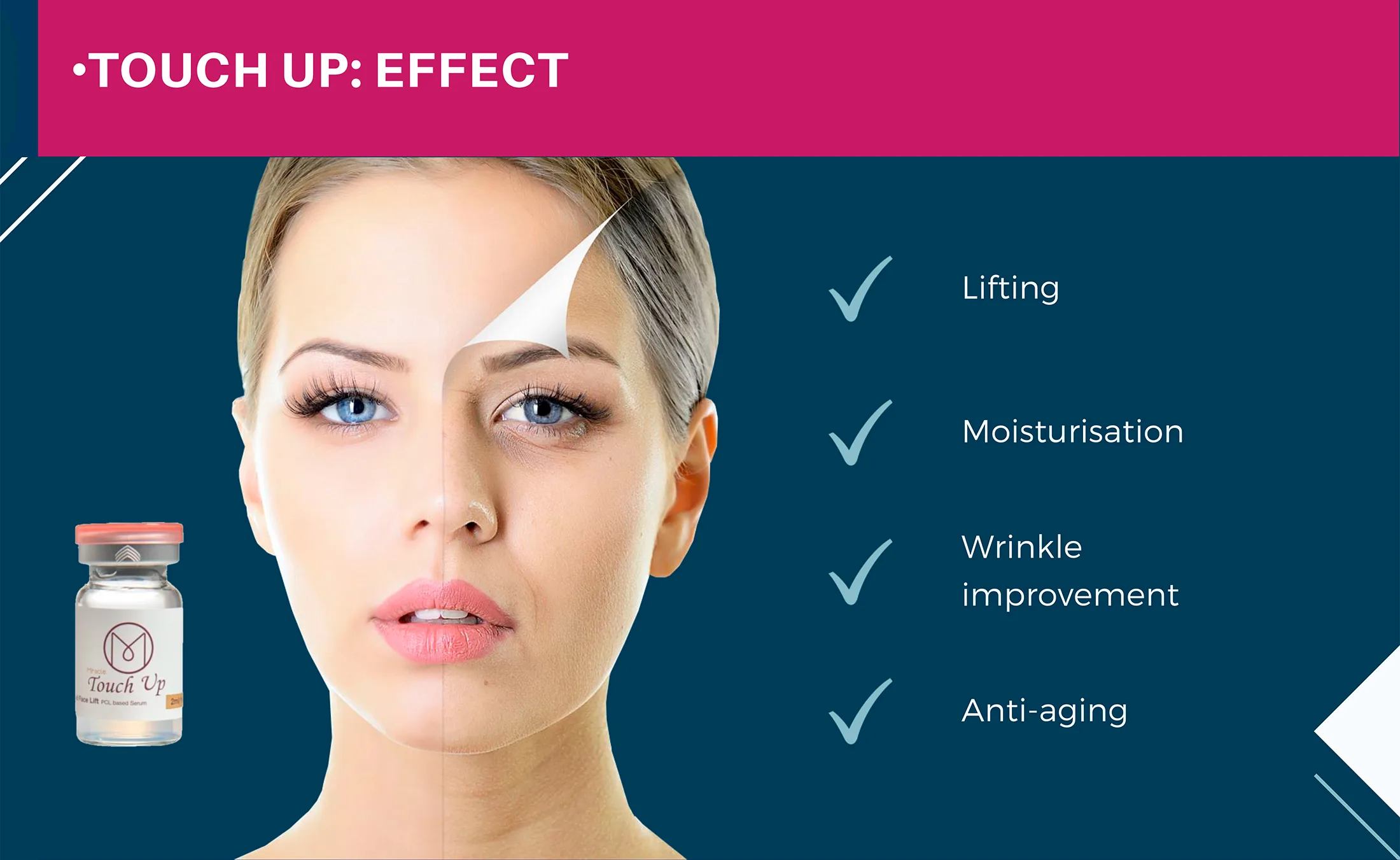 Miracle Touch Line 1 02 Bc438976 - Botoderm