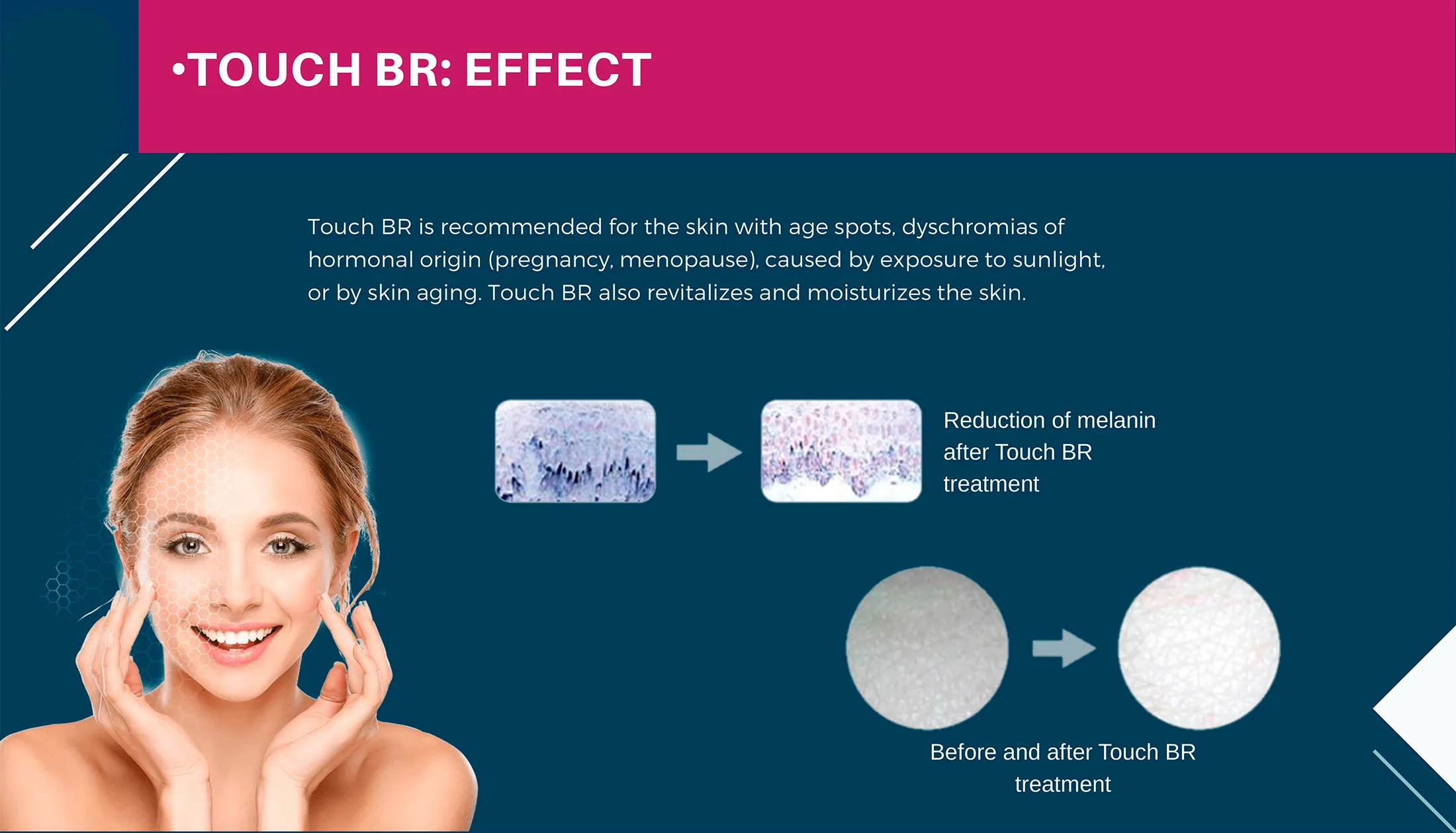 Miracle Touch Br 3 Miracle Touch Line 9 03 08Ab4397 - Botoderm