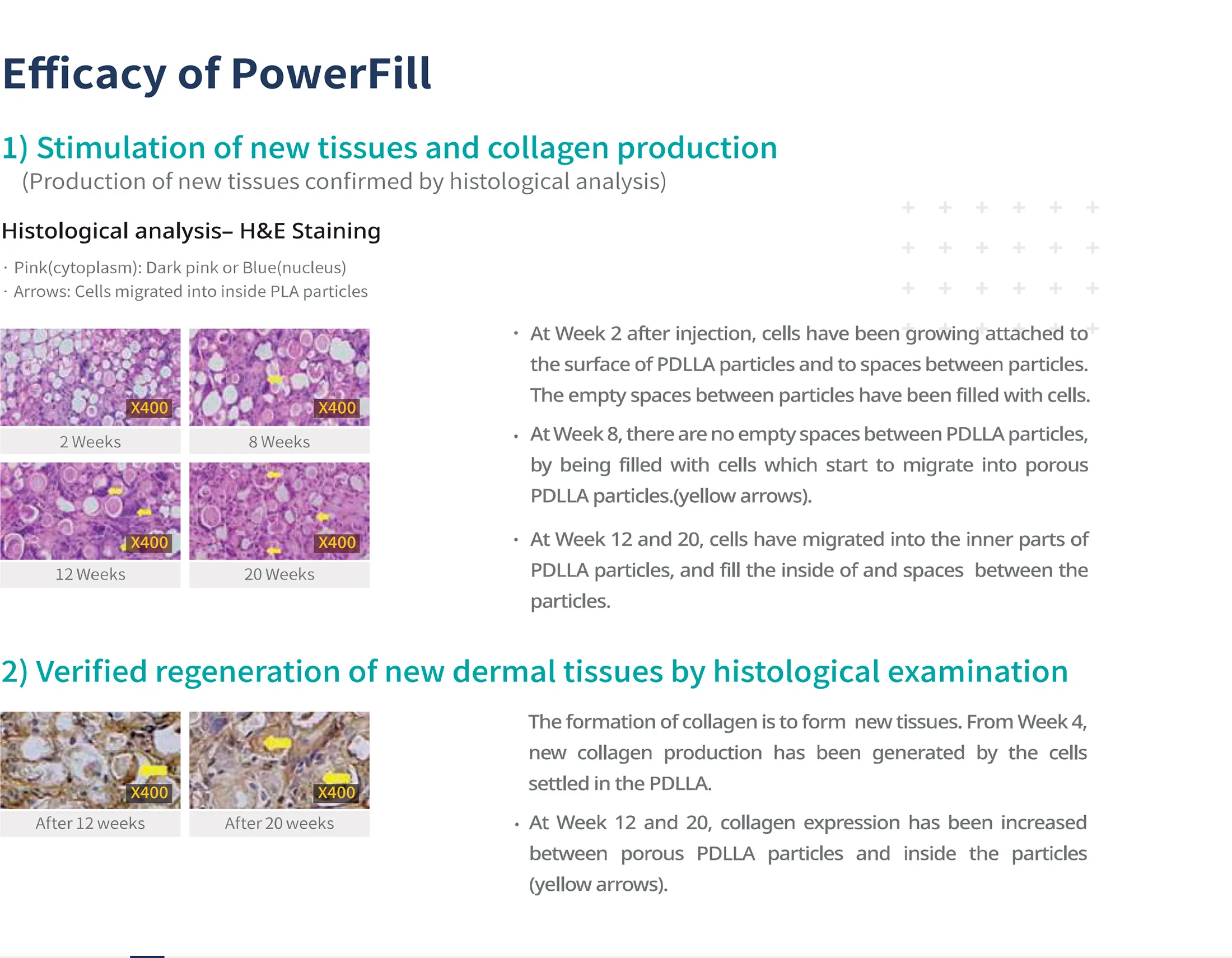 Powerfill Brochure En 1 04 294Def2E - Botoderm