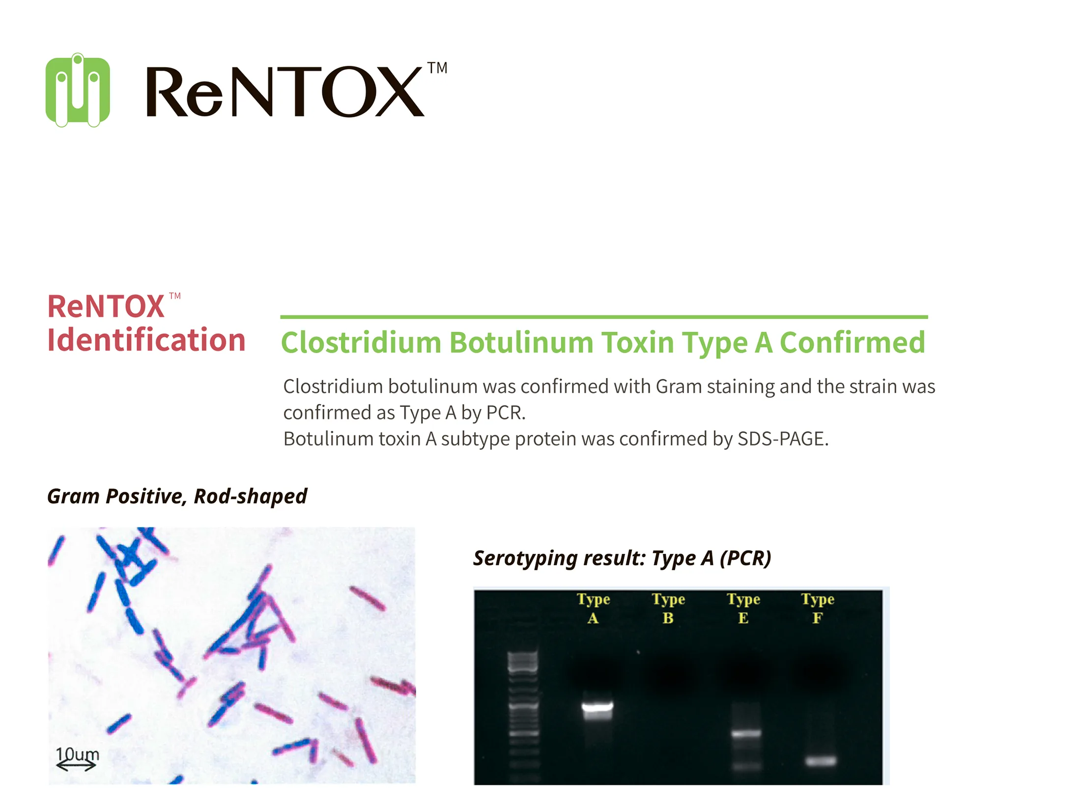 Re N Tox 2 01 9Cef4B7F - Botoderm