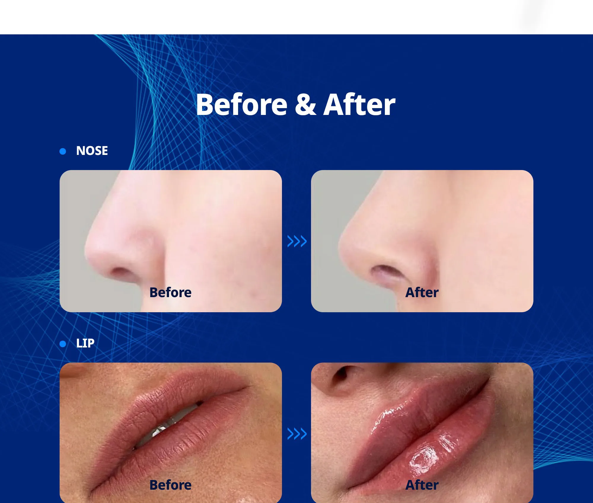 Tesoro Eng 12 292Bc685 - Botoderm