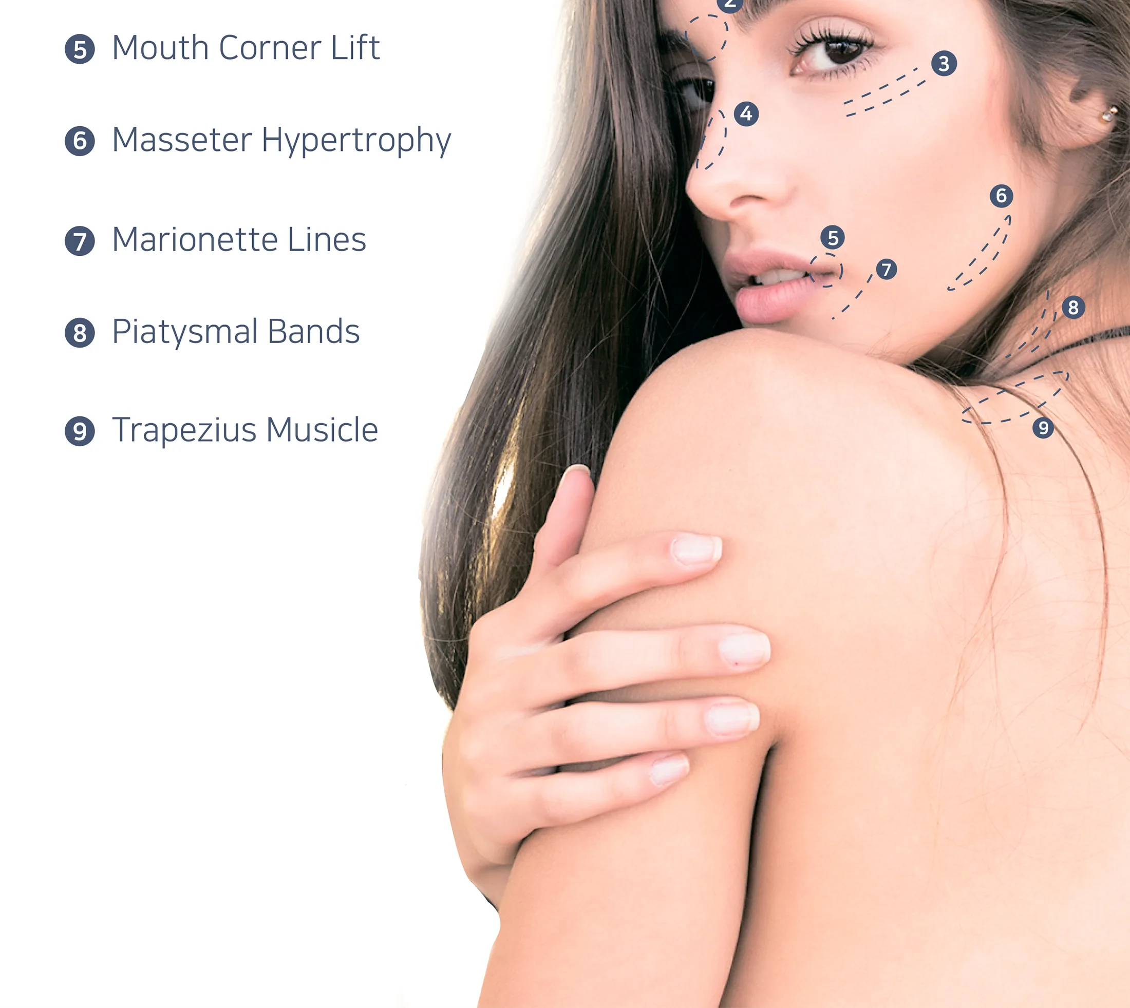 Zerotox 1 07 98588570 - Botoderm