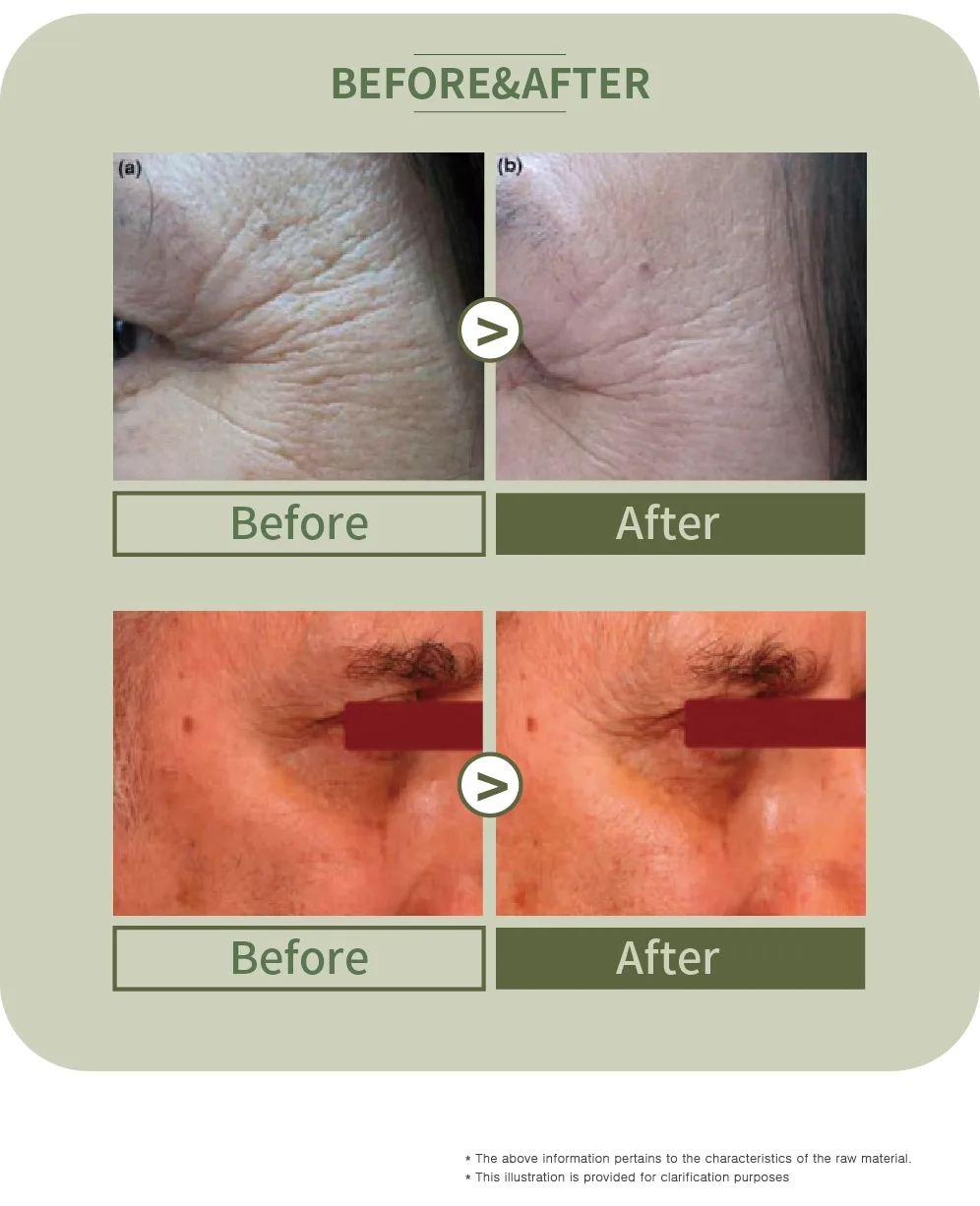 B59650Feef991 08 0076Cb66 - Botoderm