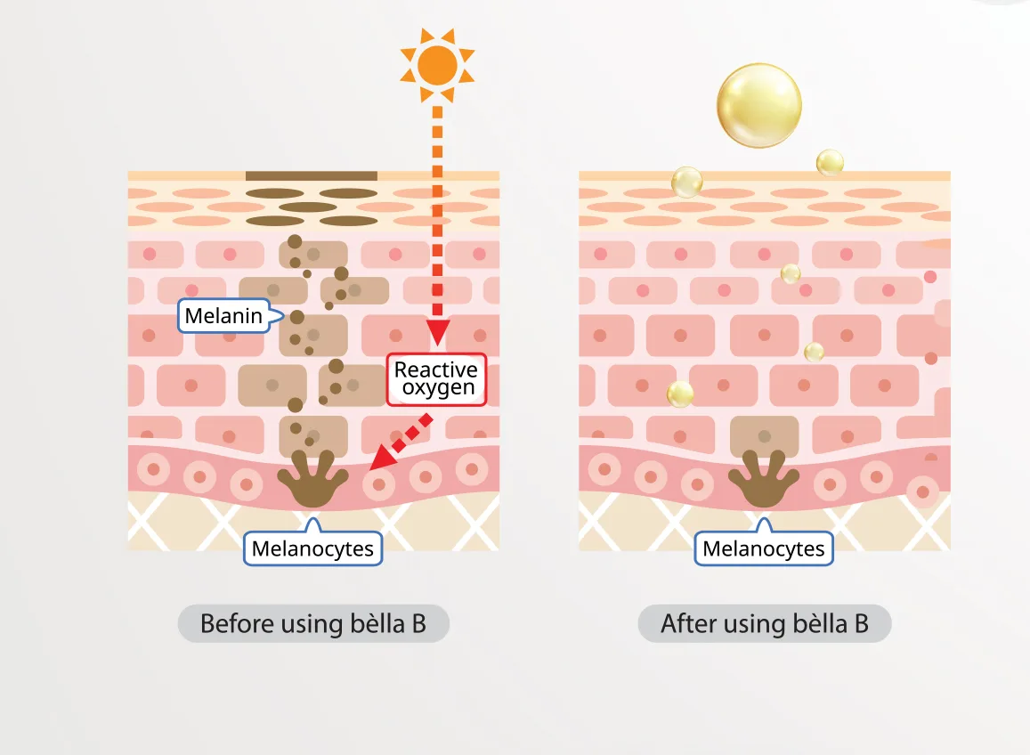 Bellab Leaflet Vf 1 05 13D93Dfb - Botoderm