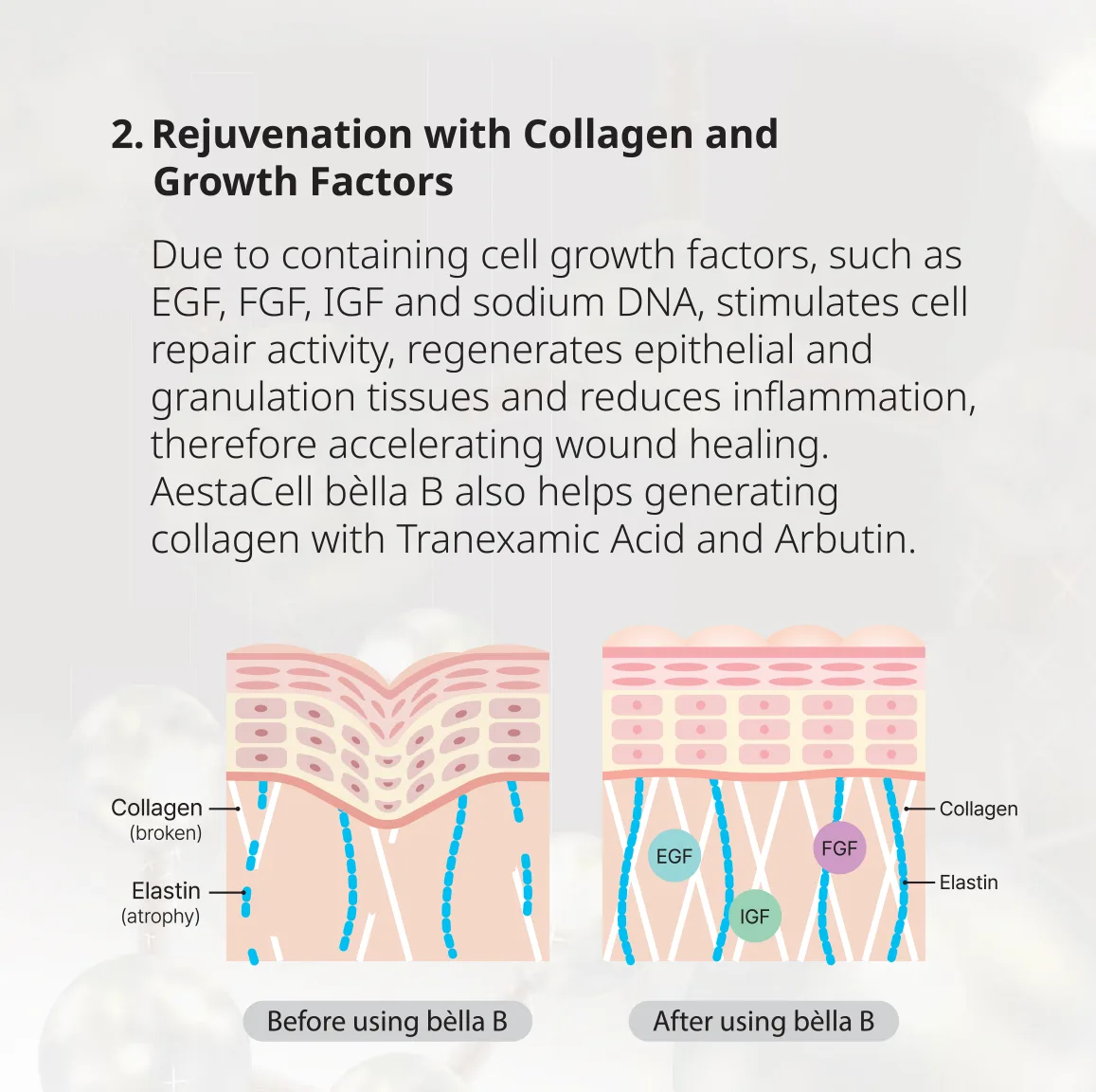 Bellab Leaflet Vf 1 06 F3Cc4630 - Botoderm
