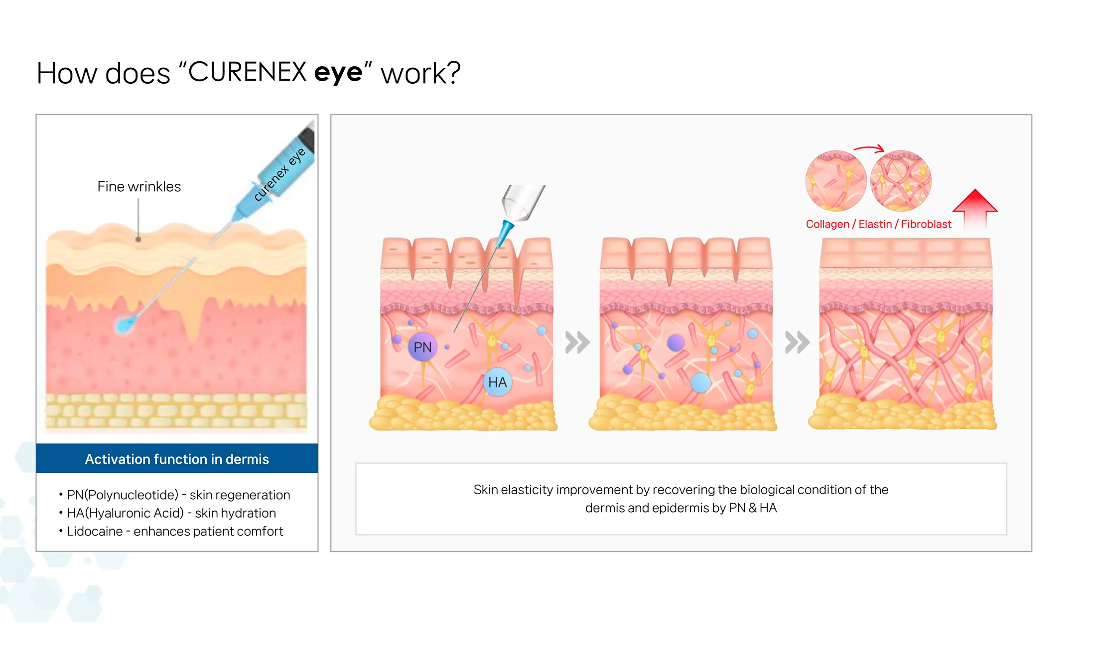 Curenex Eye 04 Eb377167 - Botoderm