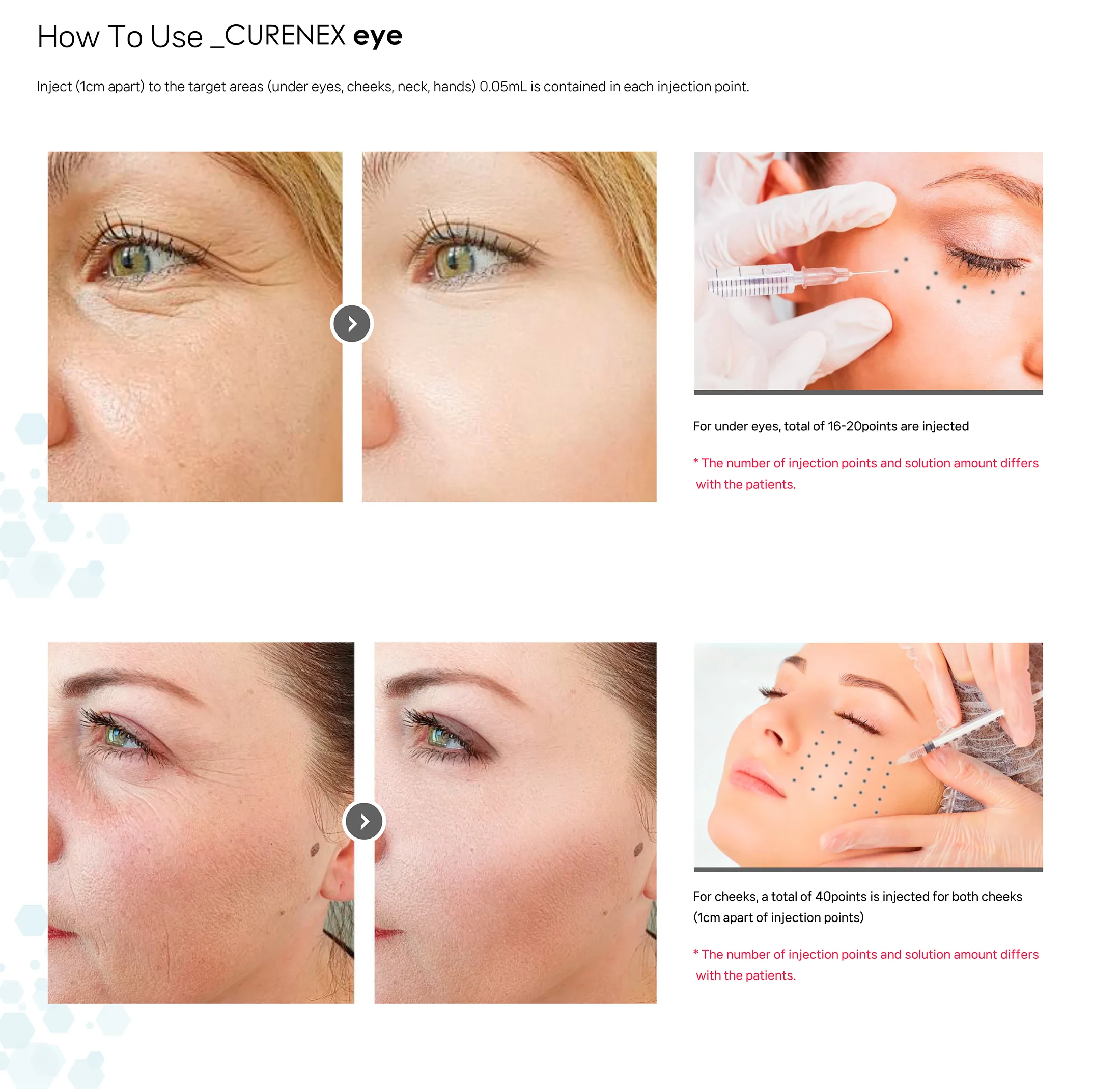 Curenex Eye 12 062C44E8 - Botoderm