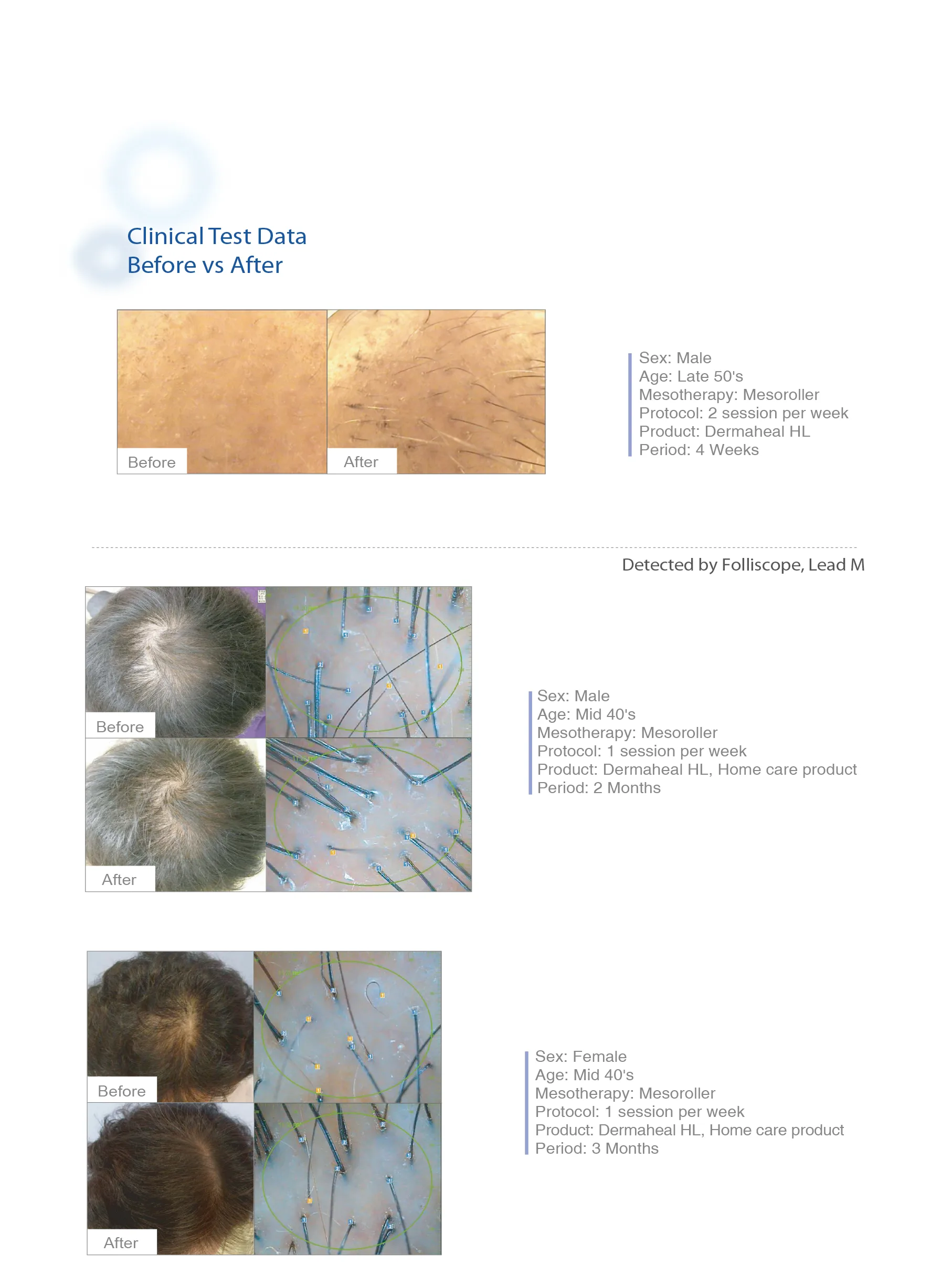 Dermaheal Hl 04 6E20Bbec - Botoderm