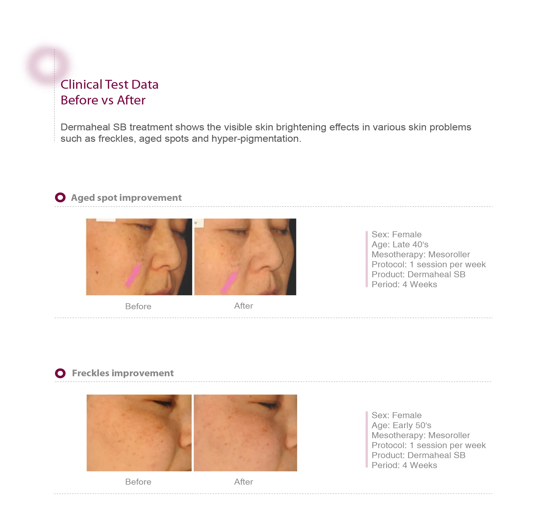 Dermaheal Sb 04 F44F5D3F - Botoderm
