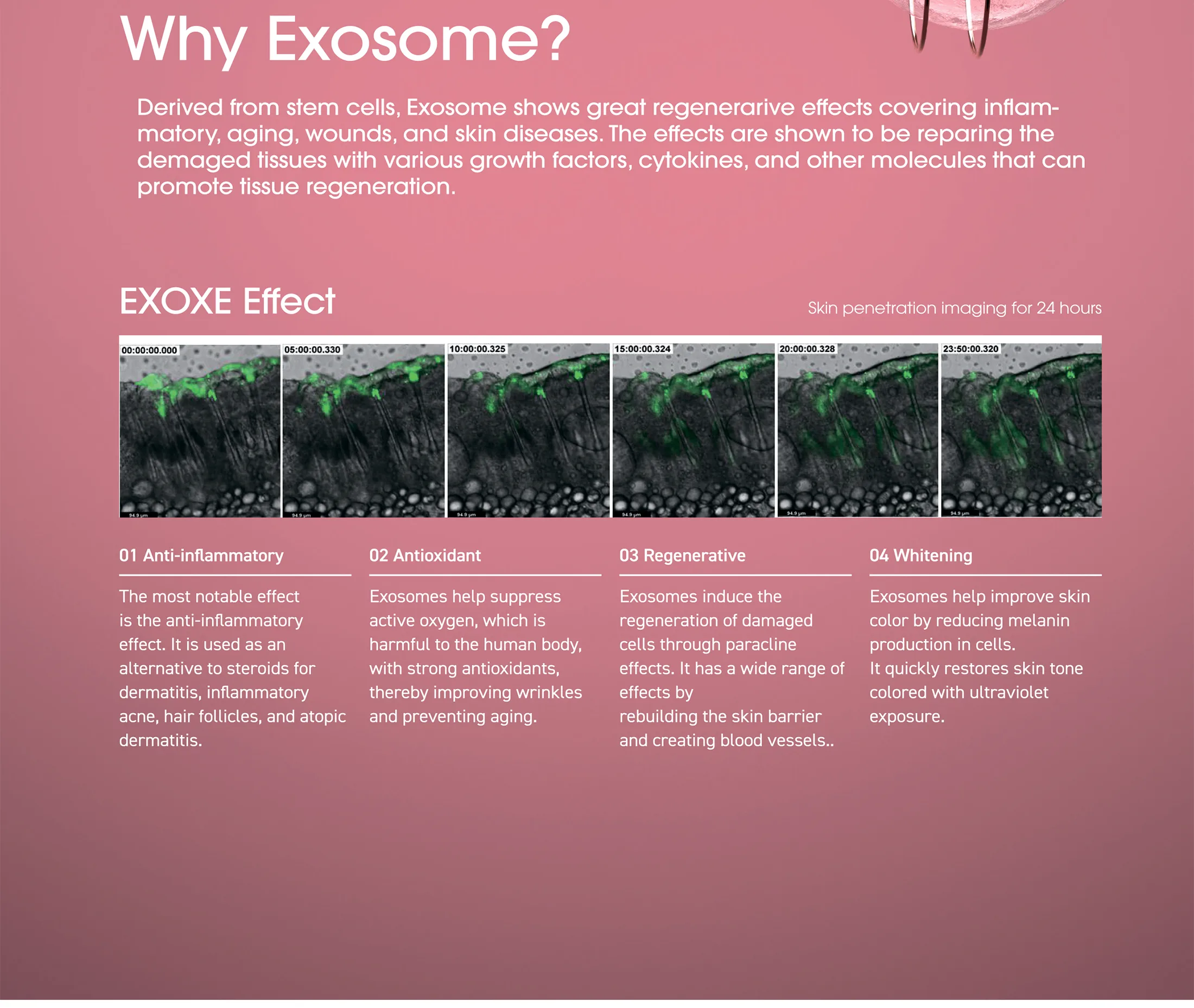 Exoxe Face 03 Dd49F4D8 - Botoderm