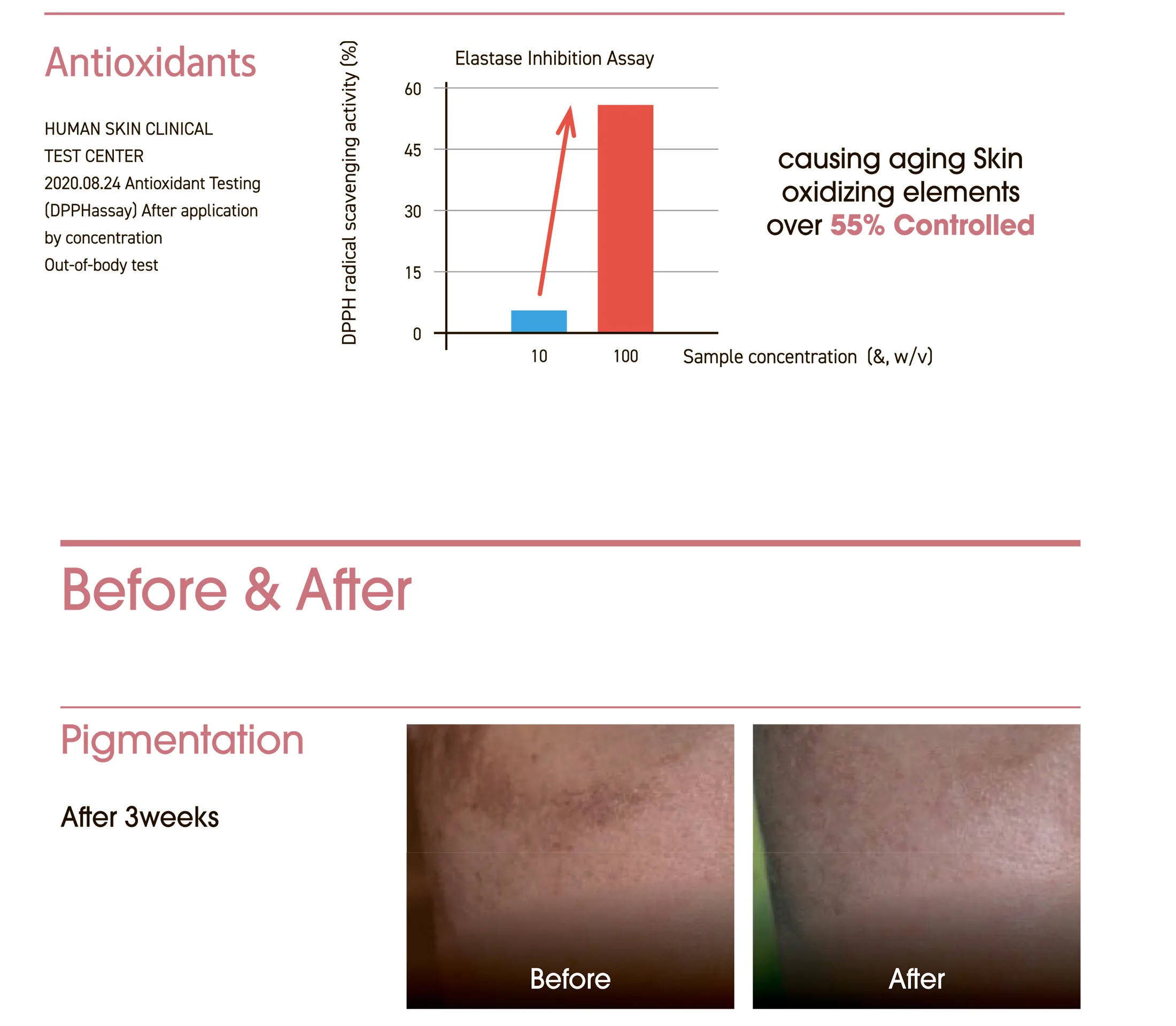 Exoxe Face 10 0Eaf1Cff - Botoderm