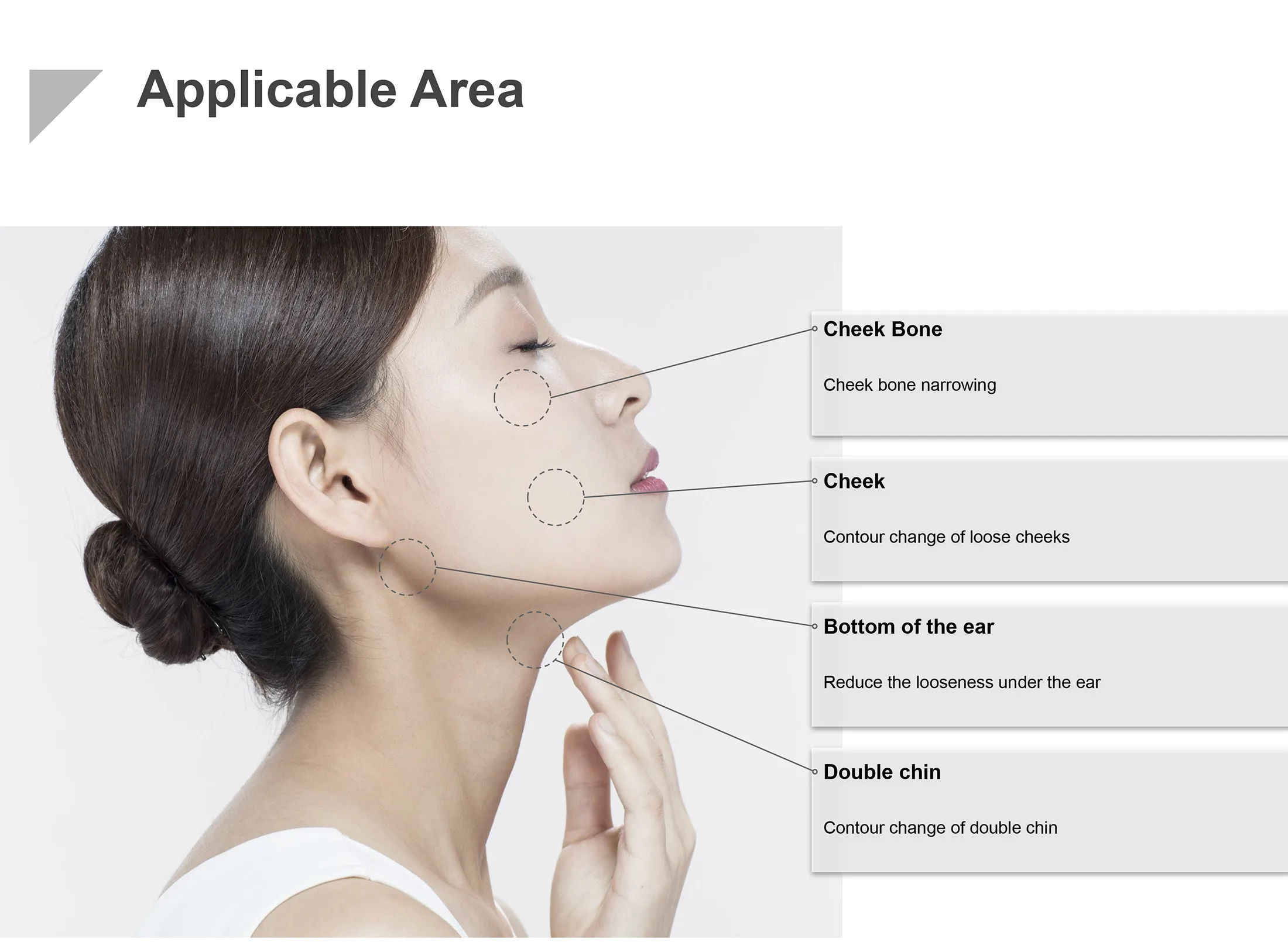 Super V Line 3 098C7165 - Botoderm