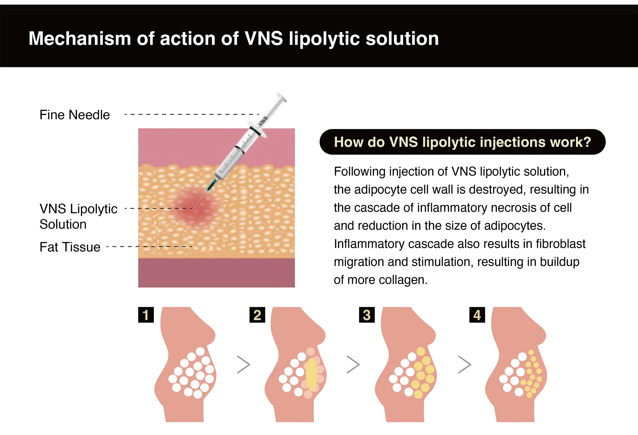 Vns Brochure 03 Ef5B5349 - Botoderm